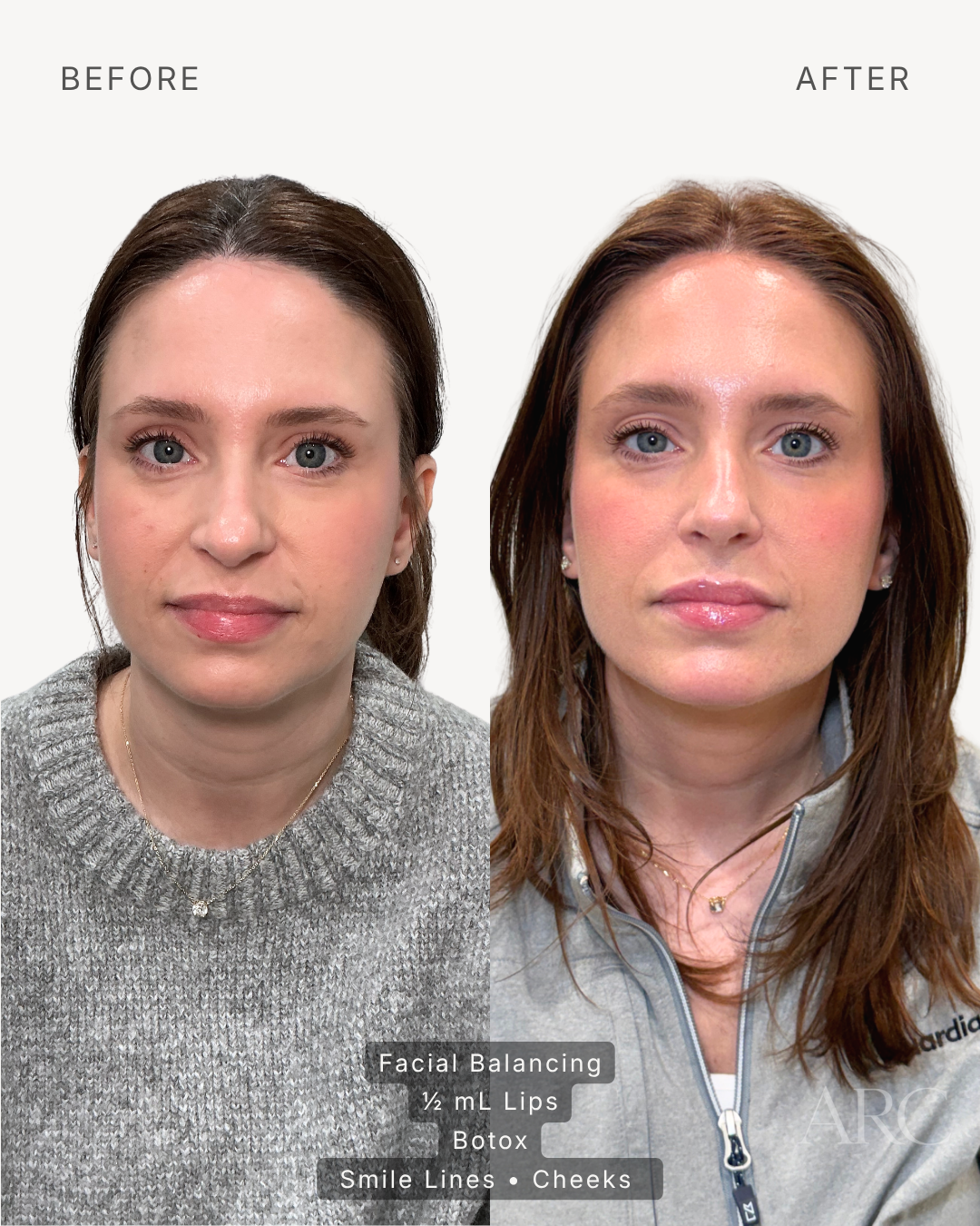 Facial Balancing