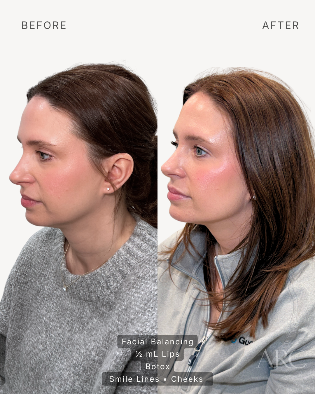 Facial Balancing
