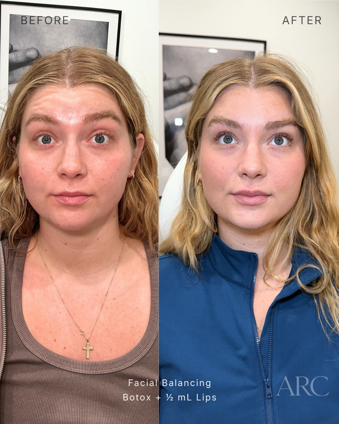 Facial Balancing
