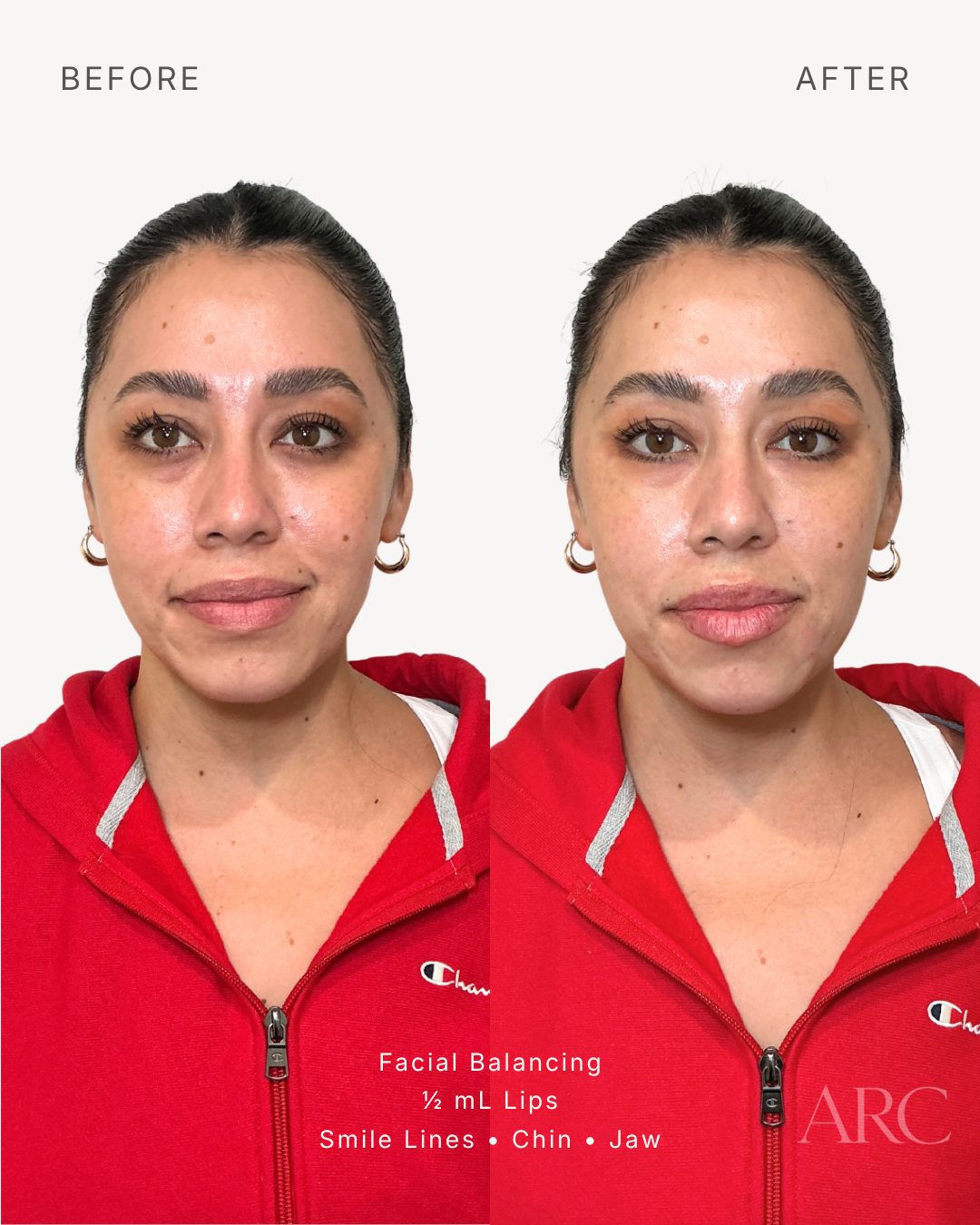 Facial Balancing
