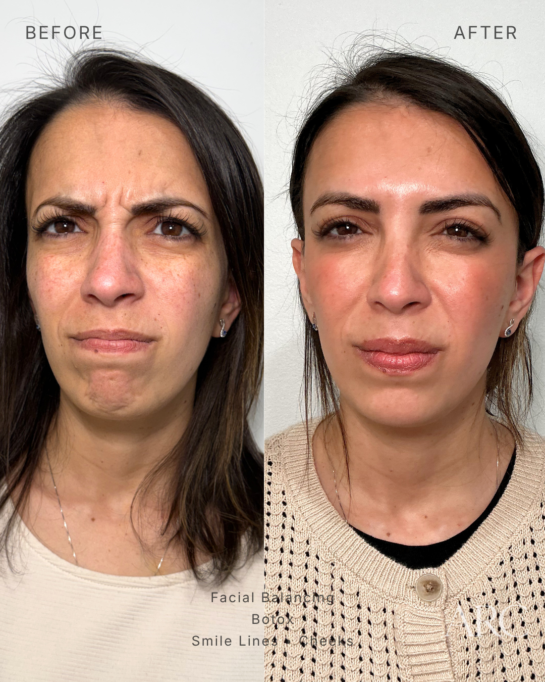 Facial Balancing