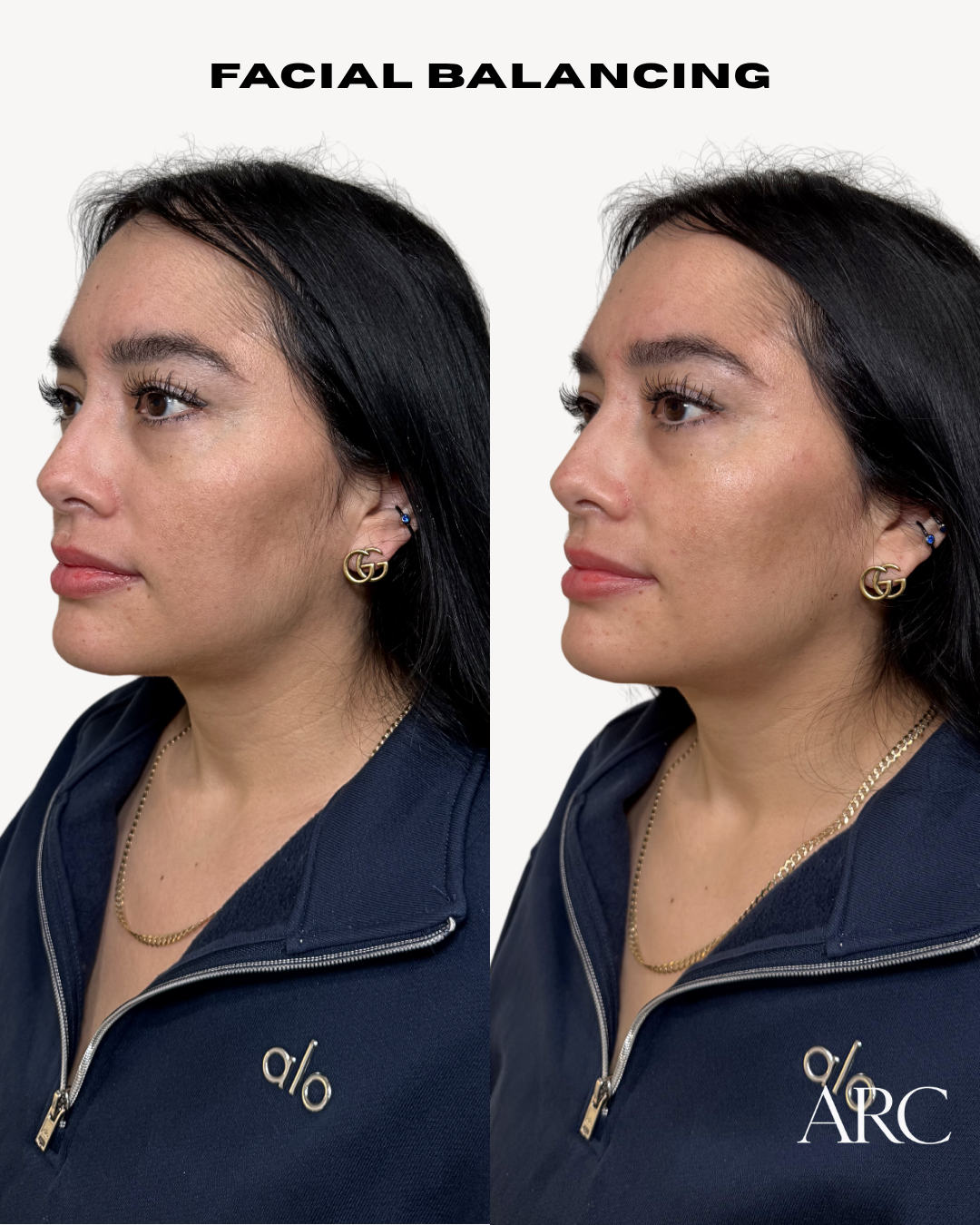 Copy of  Before and After FB - 2.png