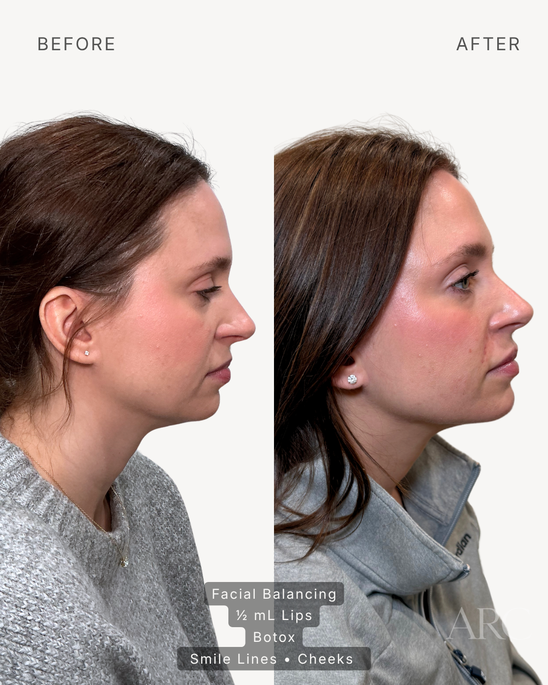 Facial Balancing