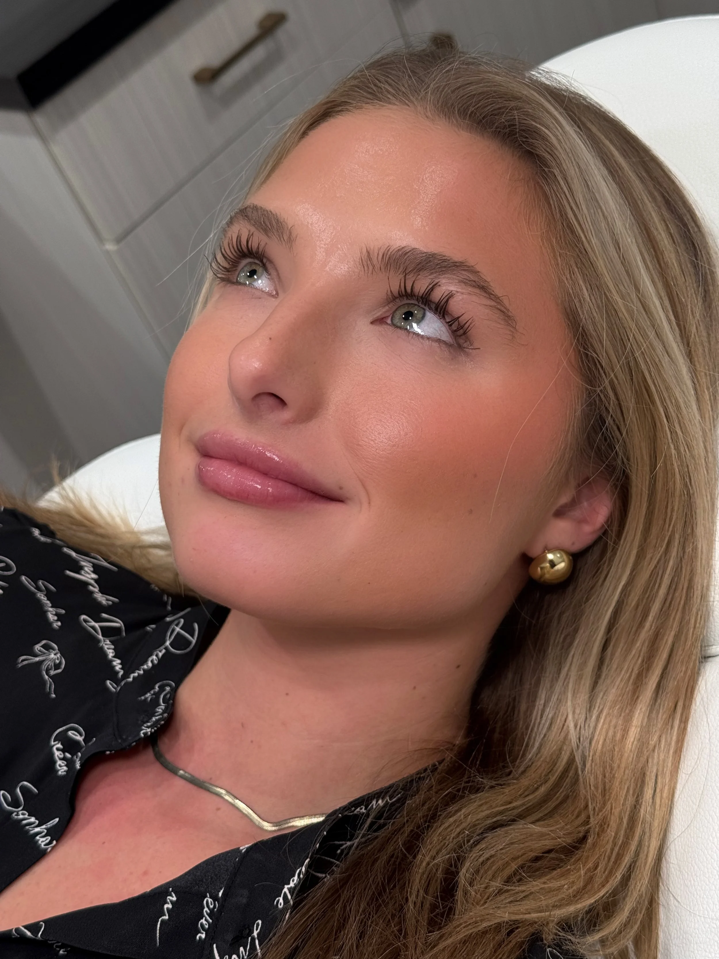 1/2 mL Lip Filler