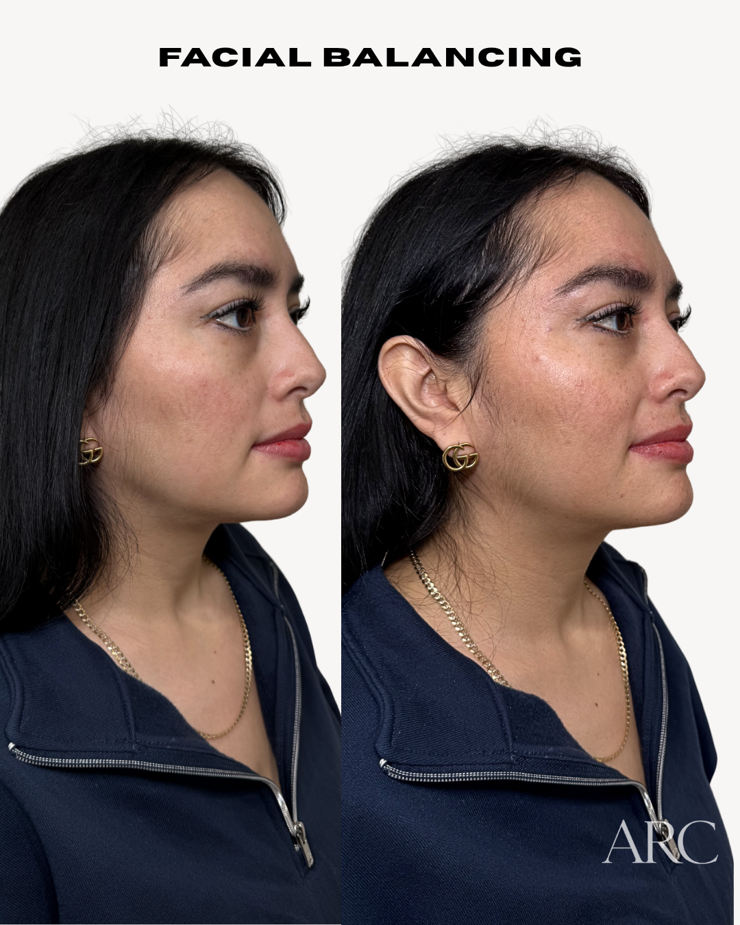 Copy of  Before and After FB - 3.png