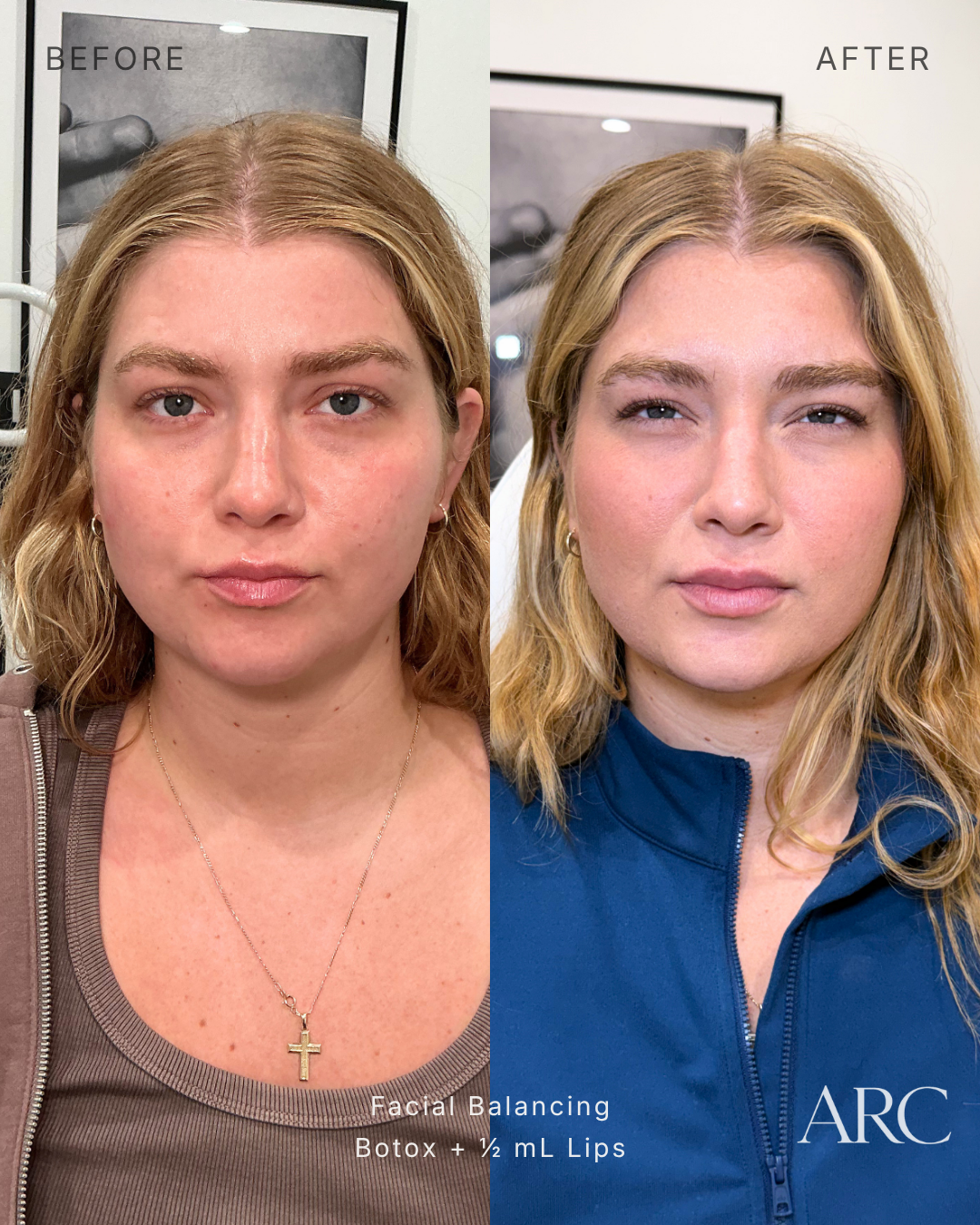 Facial Balancing