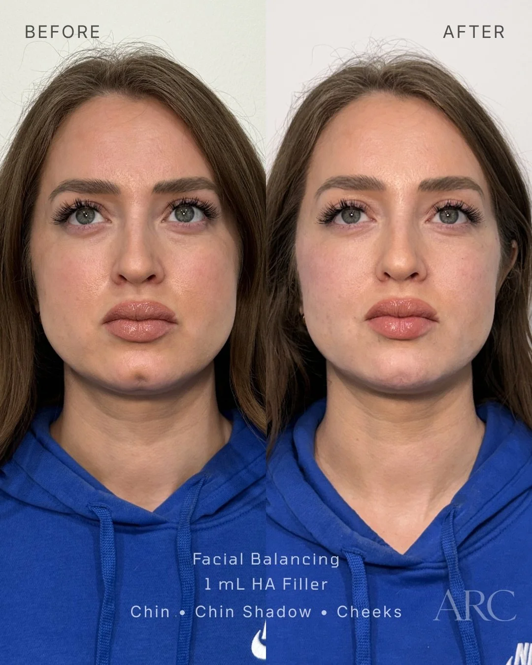Facial Balancing