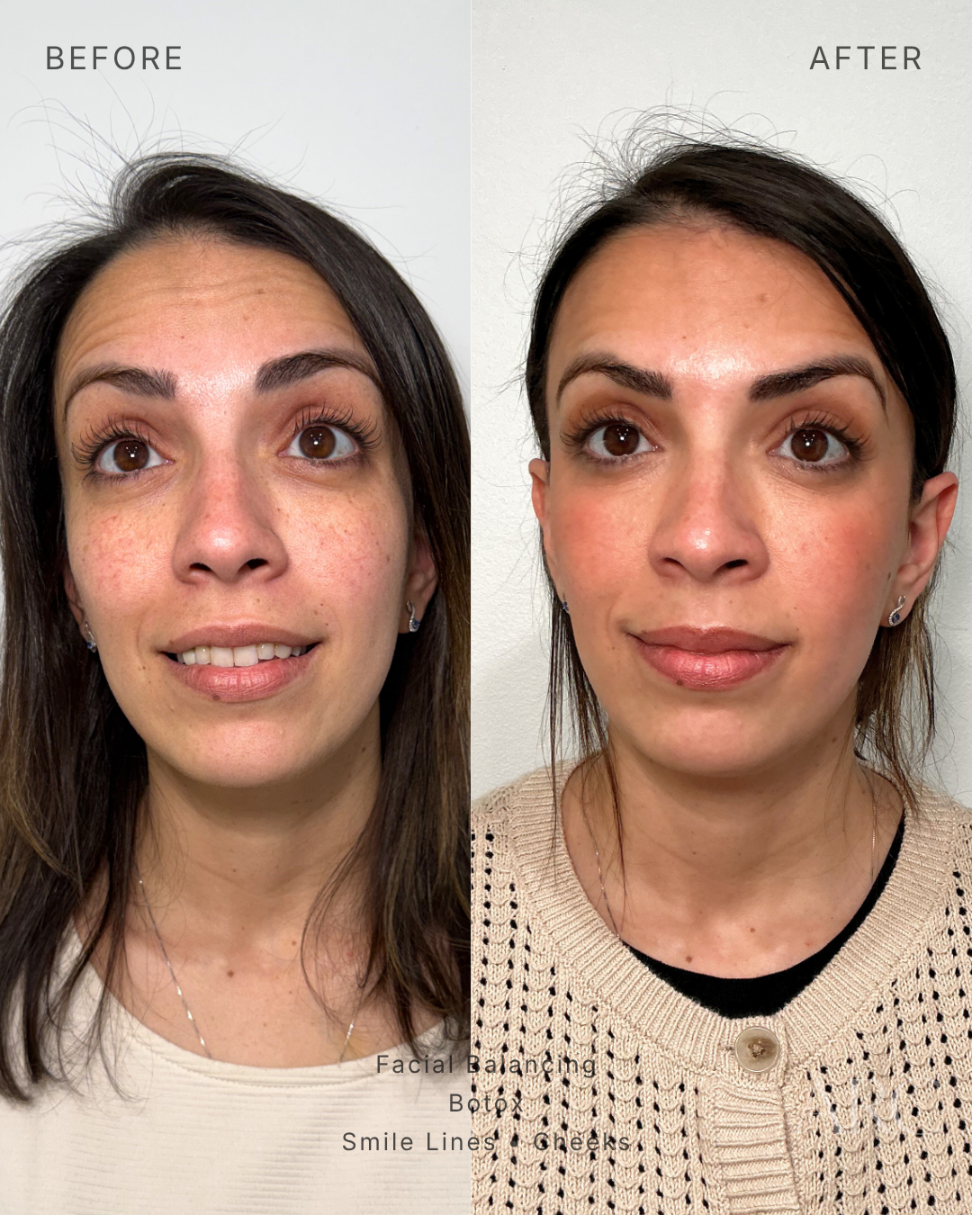 Facial Balancing