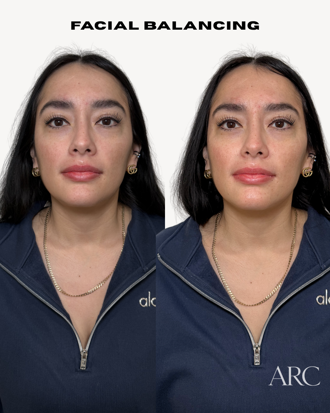 Copy of  Before and After FB - 1.png