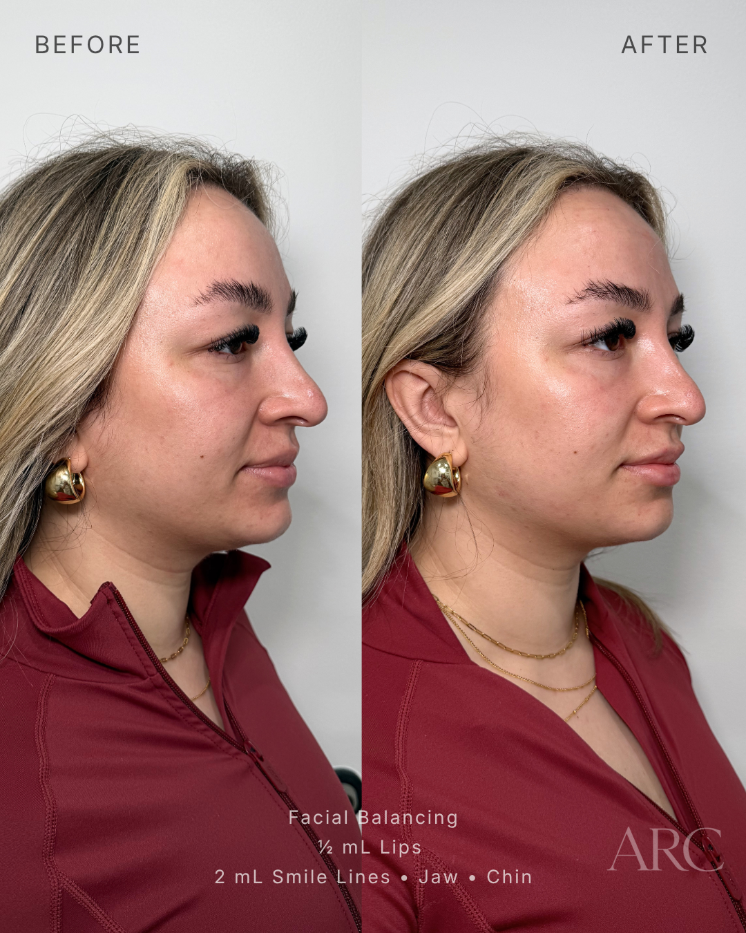 Facial Balancing