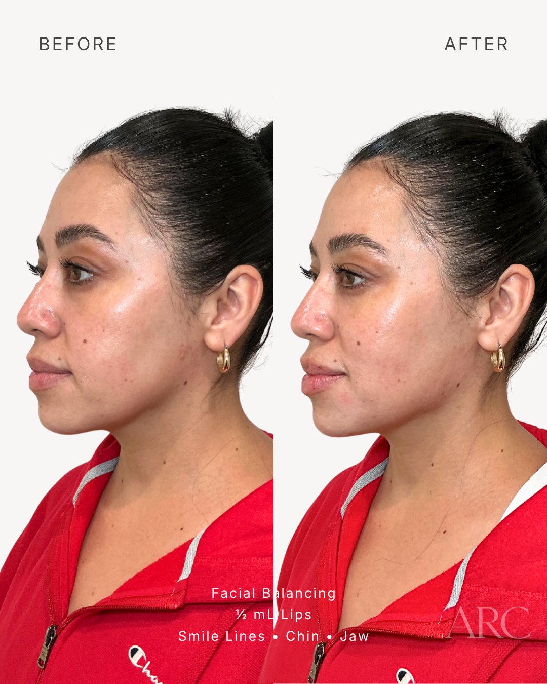 Facial Balancing