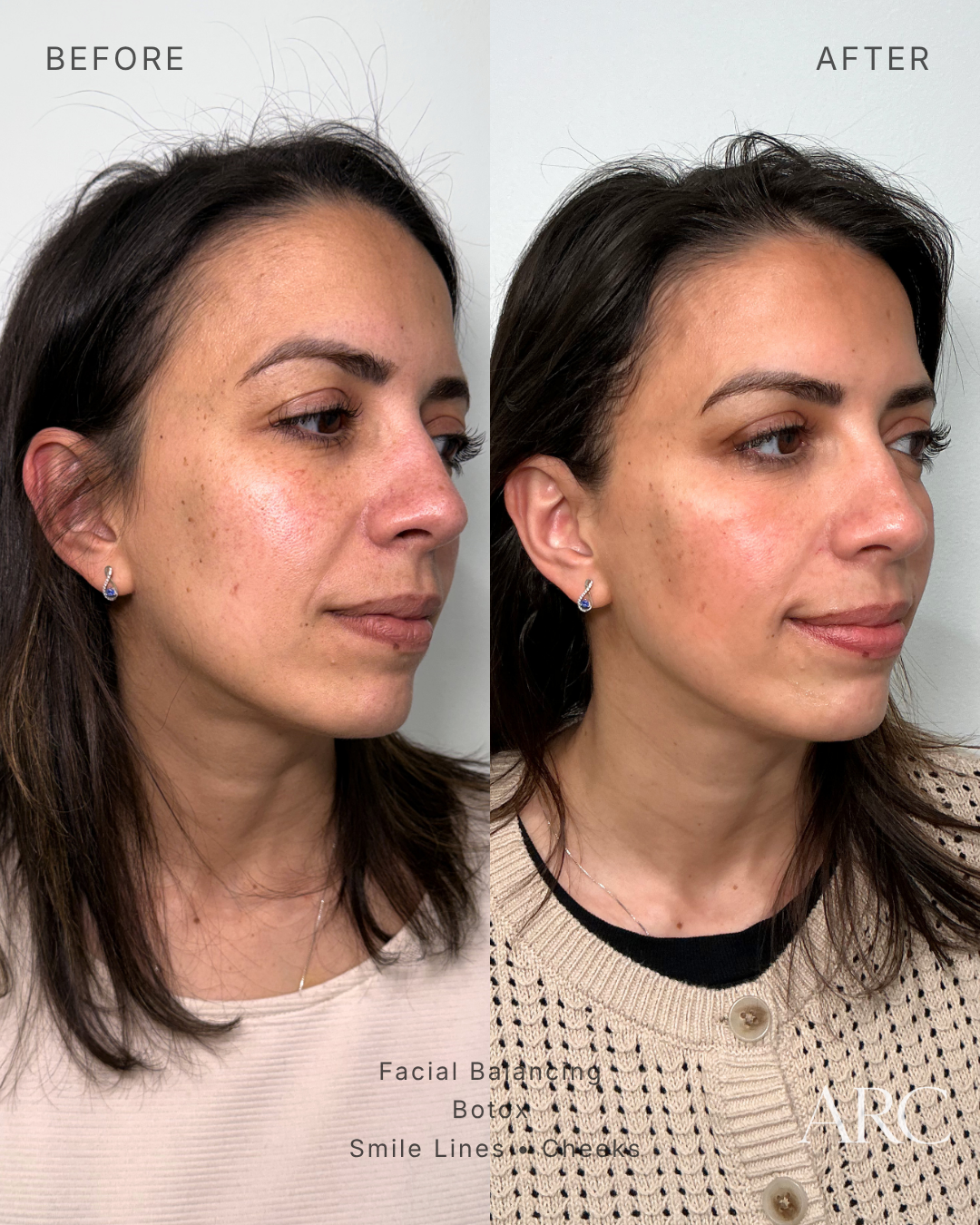 Facial Balancing
