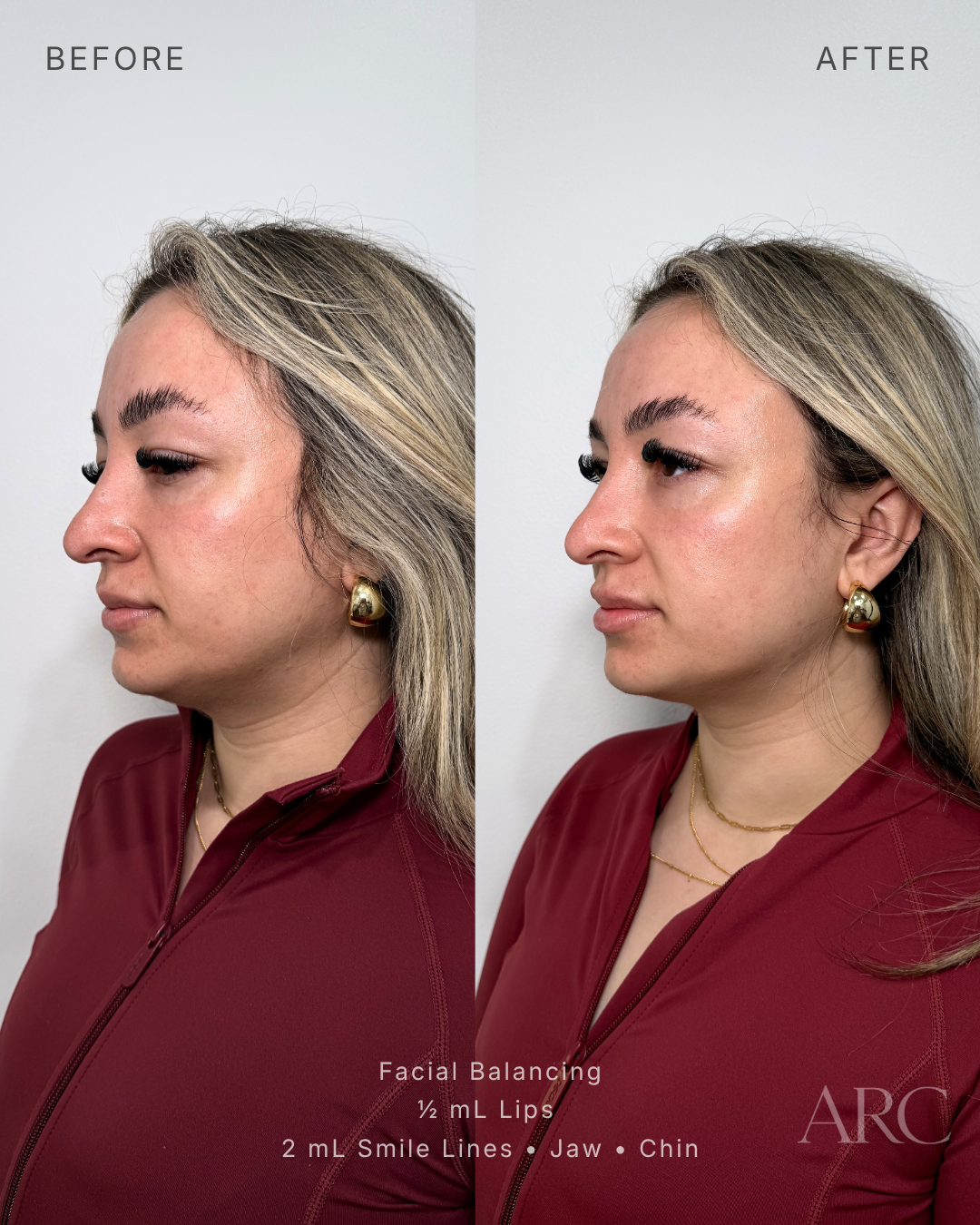 Facial Balancing
