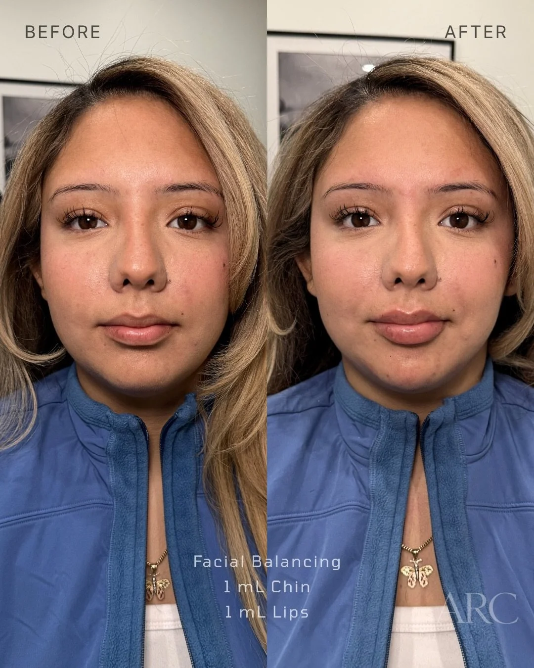 Facial Balancing