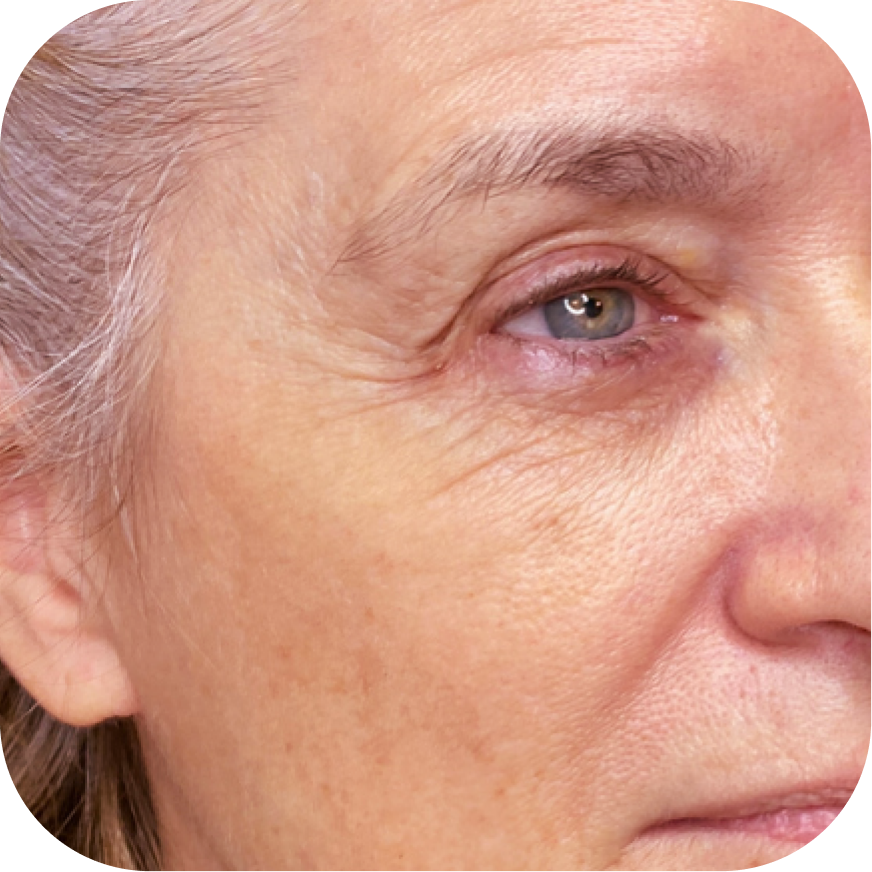 Close-up of the right side of an elderly woman's face, showing the eye, skin texture, and facial features.