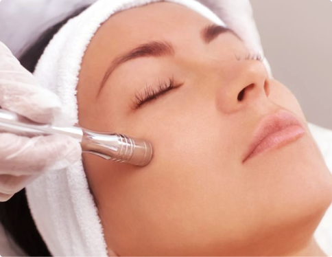 Express Microdermabrasion treatment using a diamond-tip device to gently exfoliate the skin, removing dull buildup and revealing a smoother, brighter, and more refined complexion.