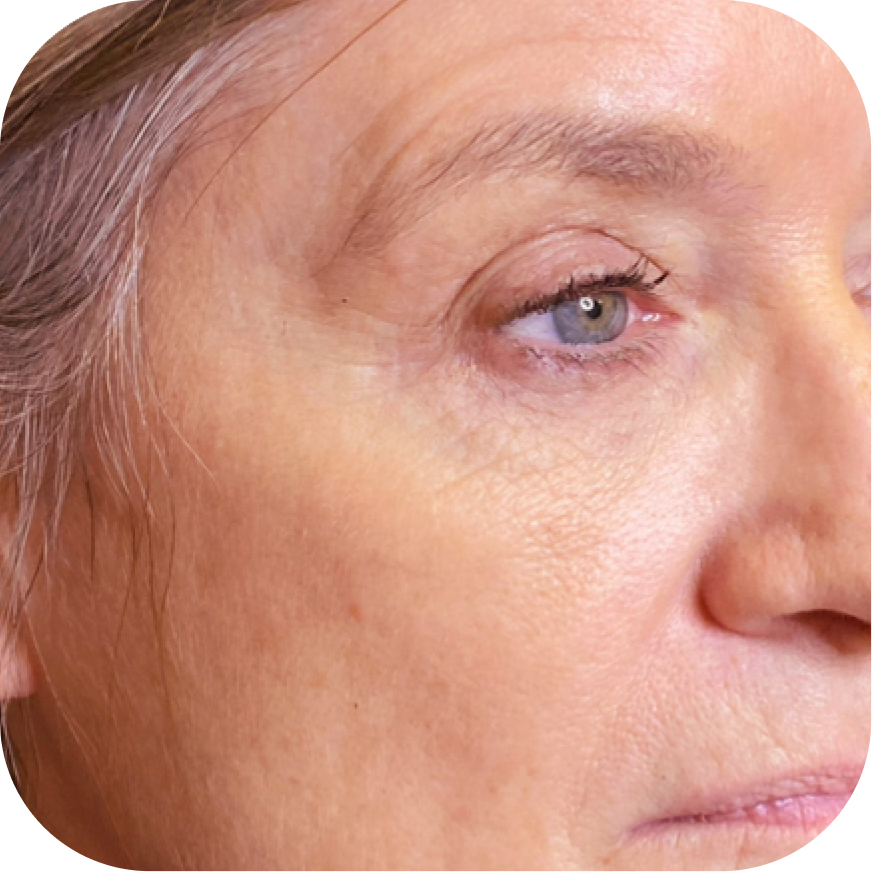 Close-up image of a woman's face highlighting her eye, eyelid, and surrounding skin with natural lighting.
