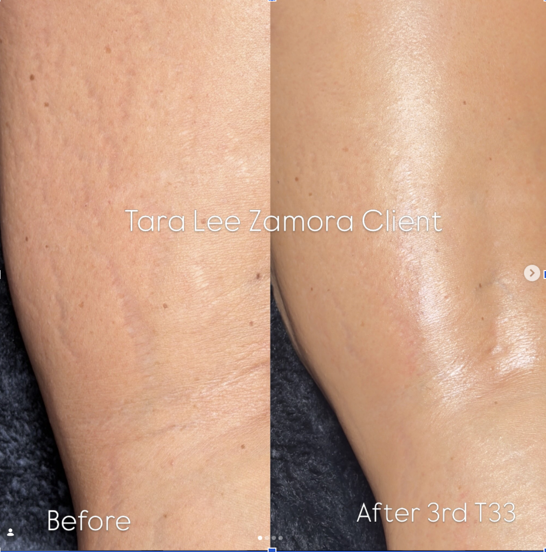Jet Plasma before and after