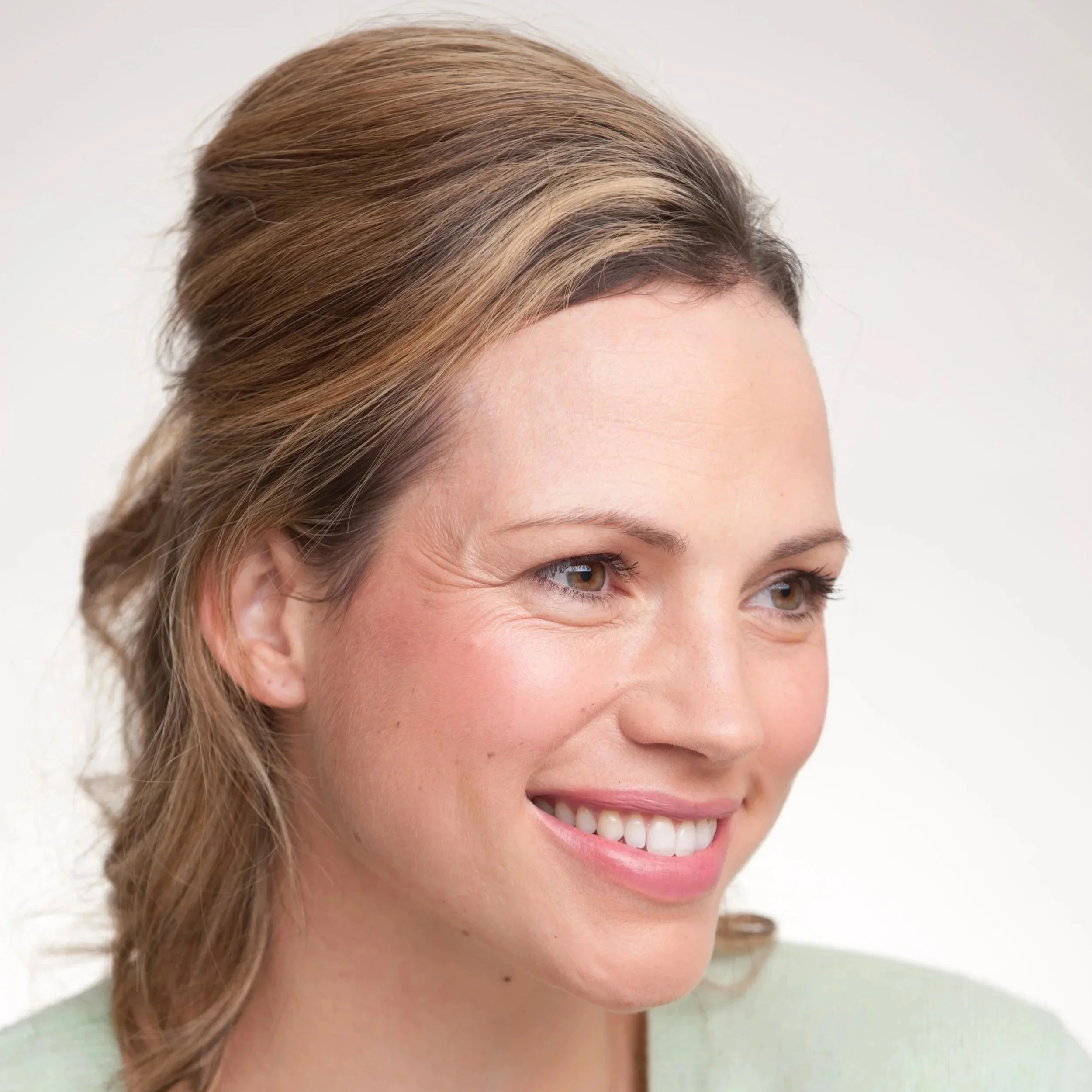 Why Sculptra Results Look Different from Filler Results — and Why That Difference Matters - PART II