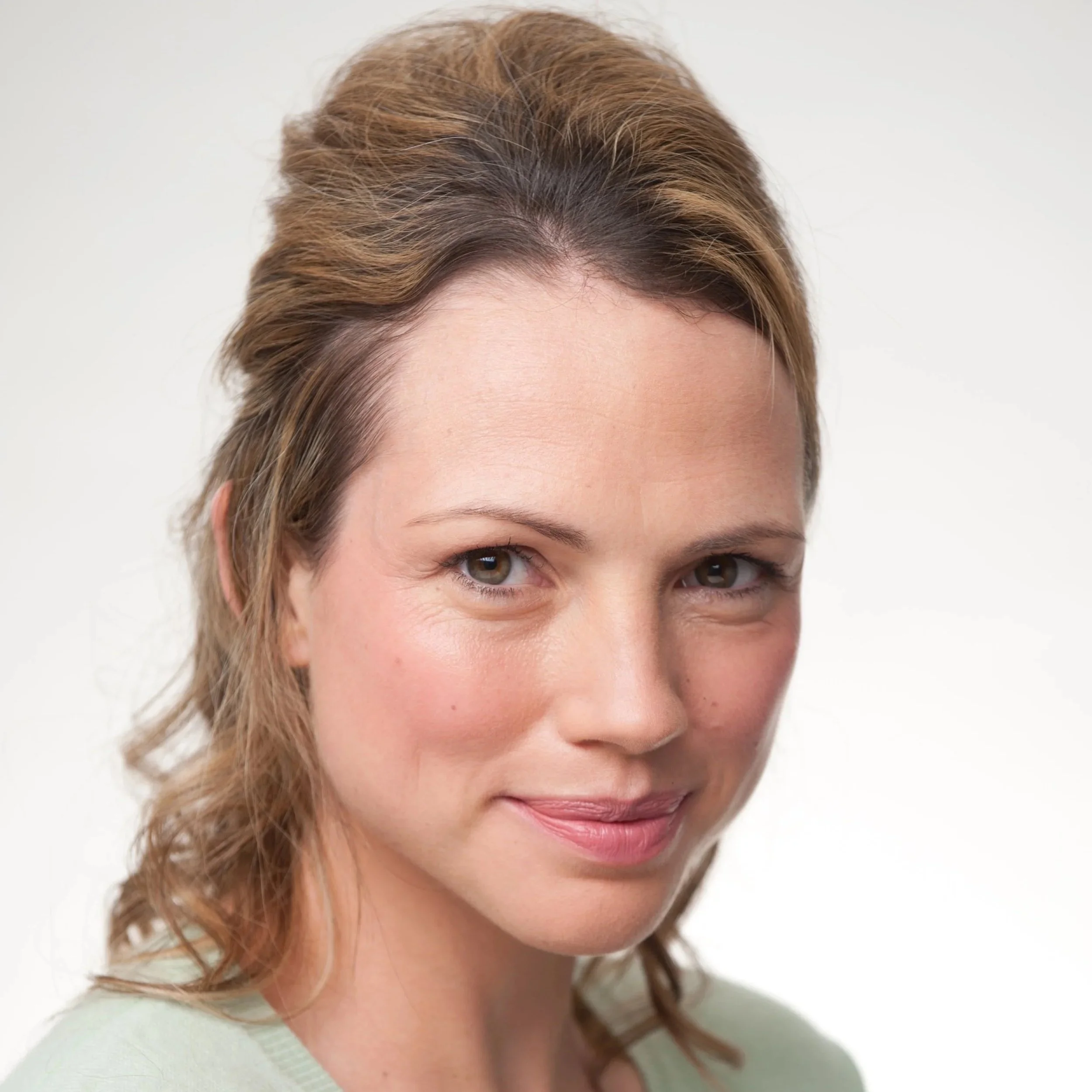Dermal Fillers - The Problem with Only Noticing the Bad Ones