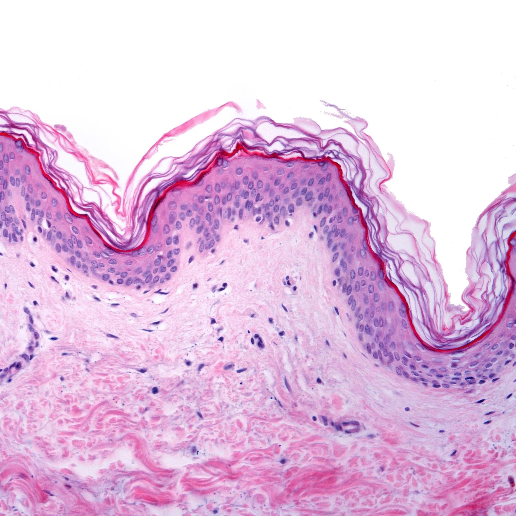 Collagen — What It Is, Why You Lose It, and Why It Matters for Your Skin
