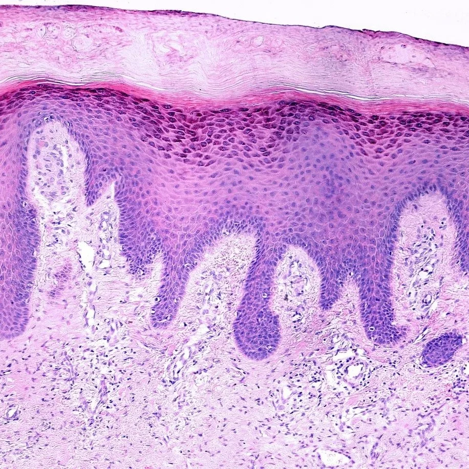 The Skin Barrier — What It Is, What It Does, What Disrupts It, and How to Strengthen It