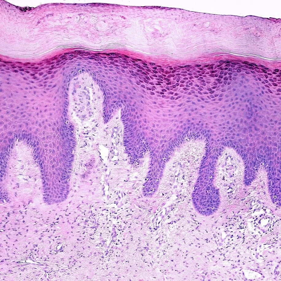 The Skin Barrier — What It Is, Why It Matters, and How to Keep It Healthy
