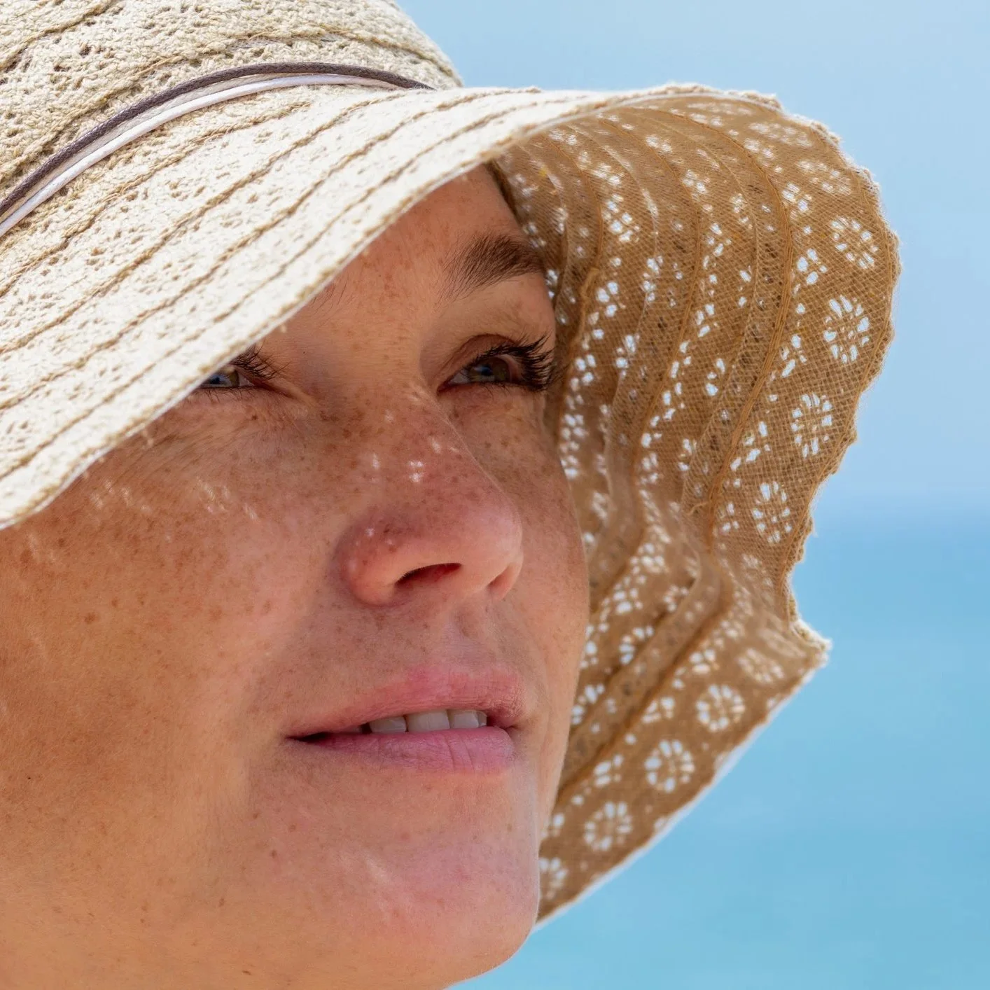 Can My Sun-damaged Skin Be Improved?
