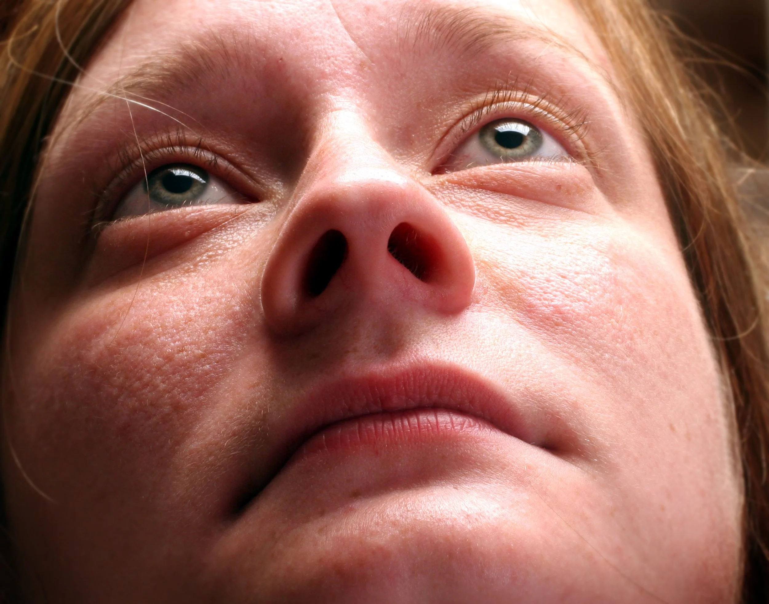 The “Ozempic” Face After Significant Weight Loss