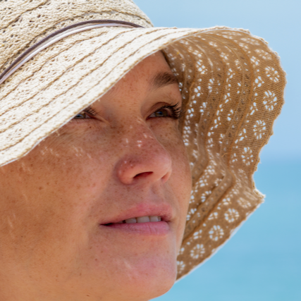 Can My Sun-damaged Skin Be Improved?