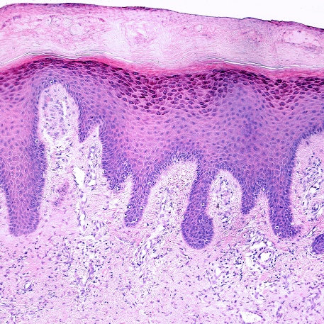The Skin Barrier — What It Is, What It Does, What Disrupts It, and How to Strengthen It