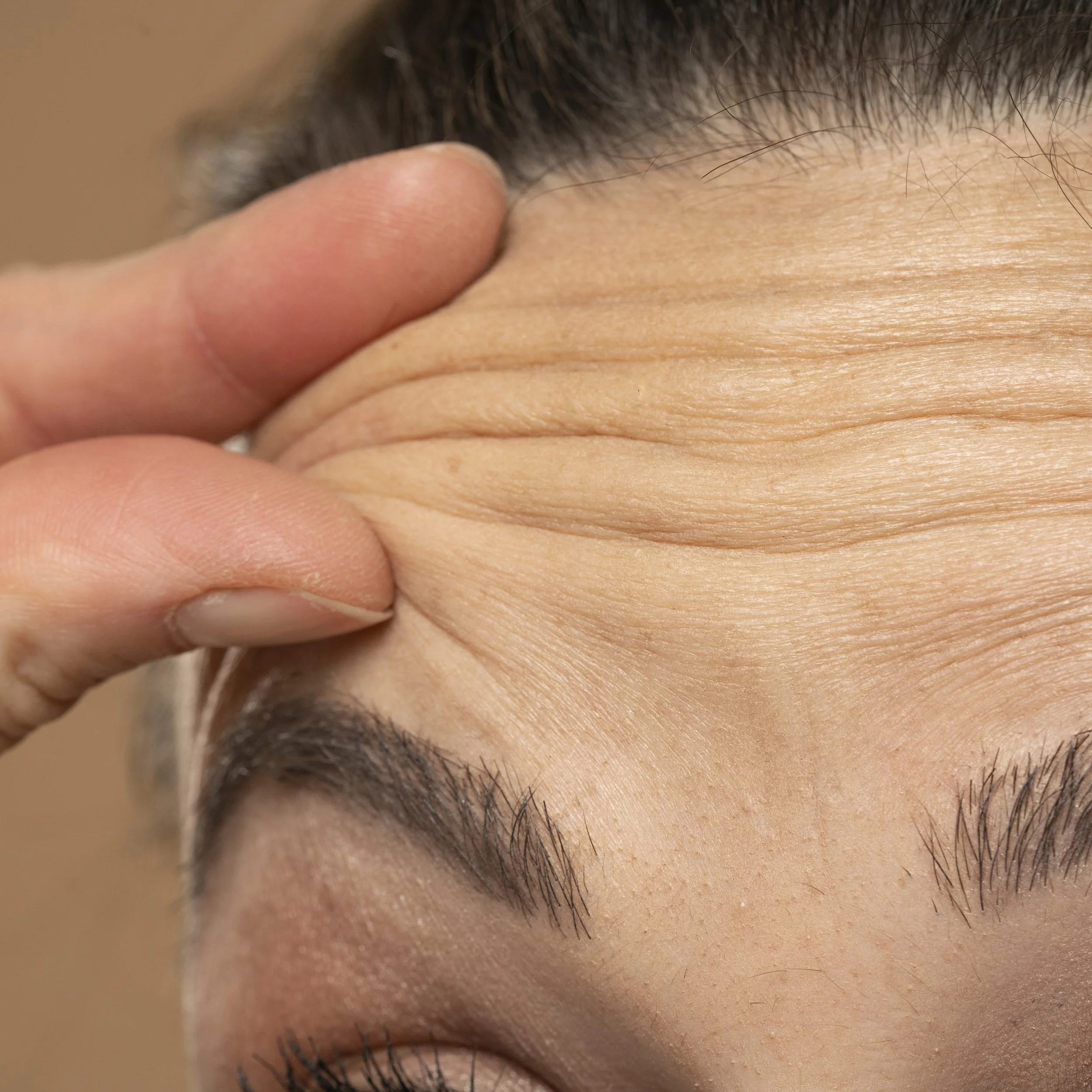 Is Baby Botox Worth It?