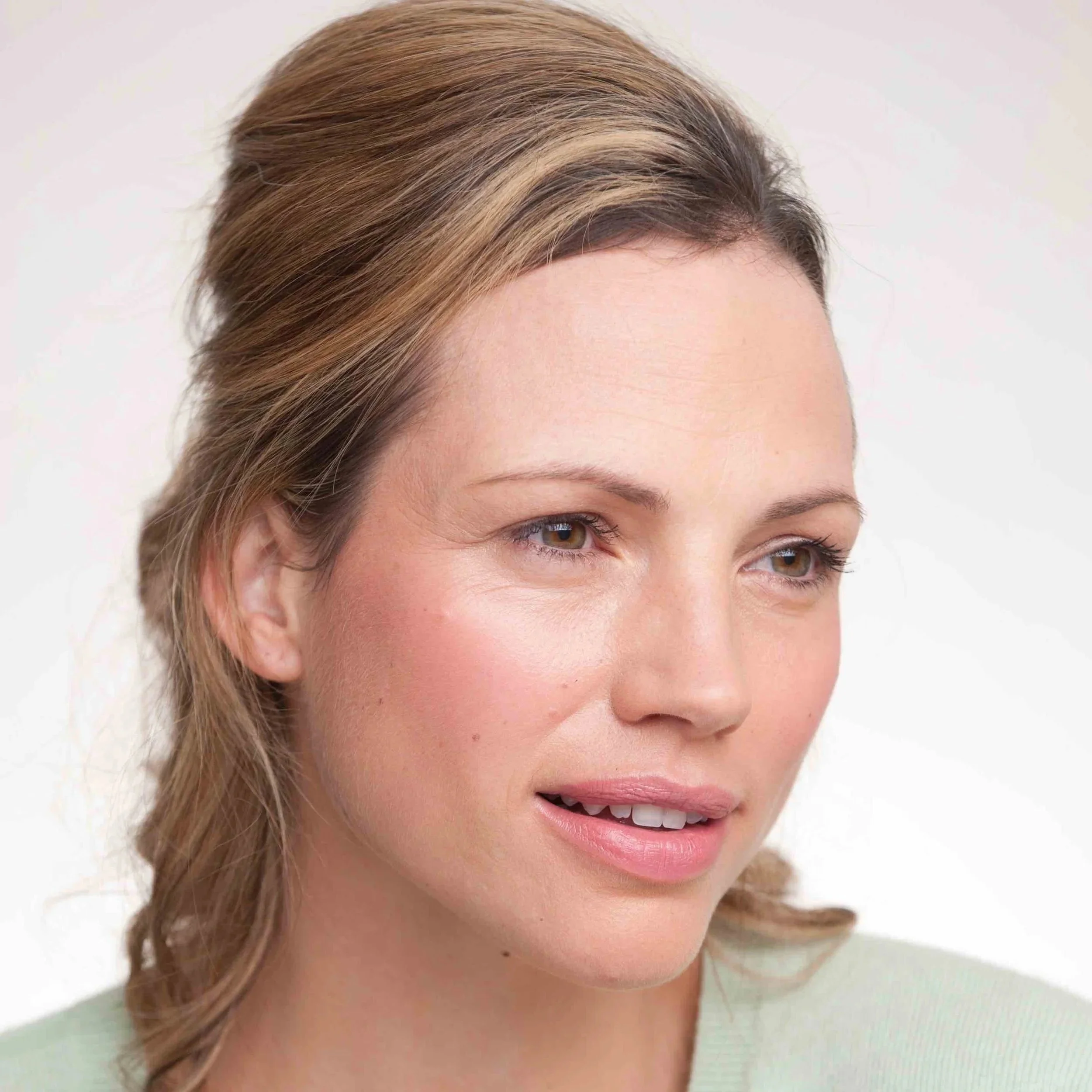 What Is the Difference Between Sculptra and Dermal Fillers?
