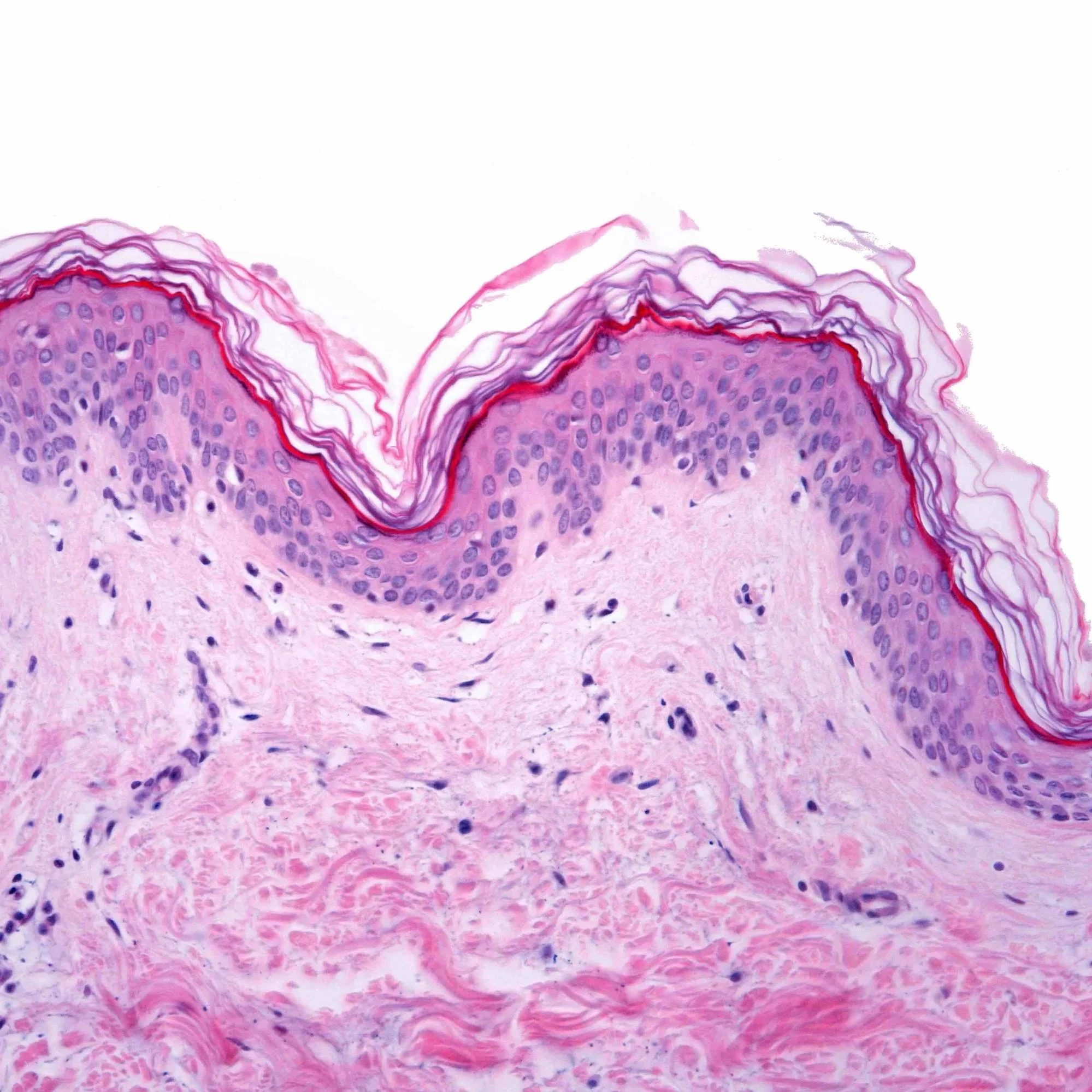 Where Has My Collagen Gone ?