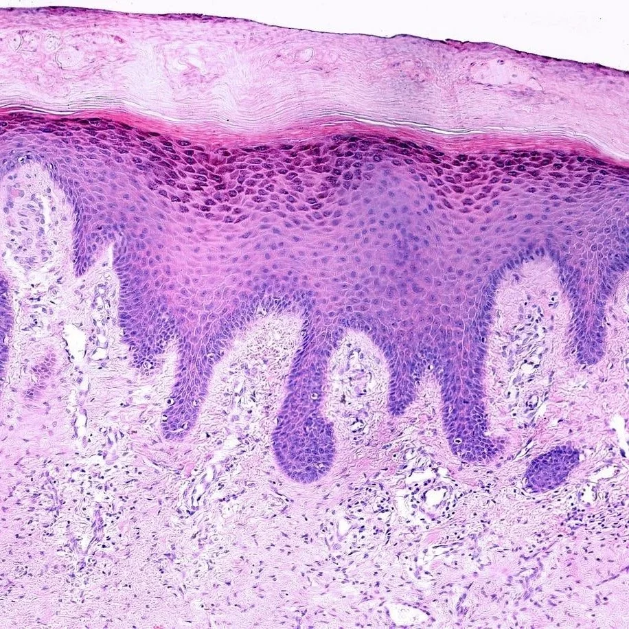 The Skin Barrier — What It Is, Why It Matters, and How to Keep It Healthy