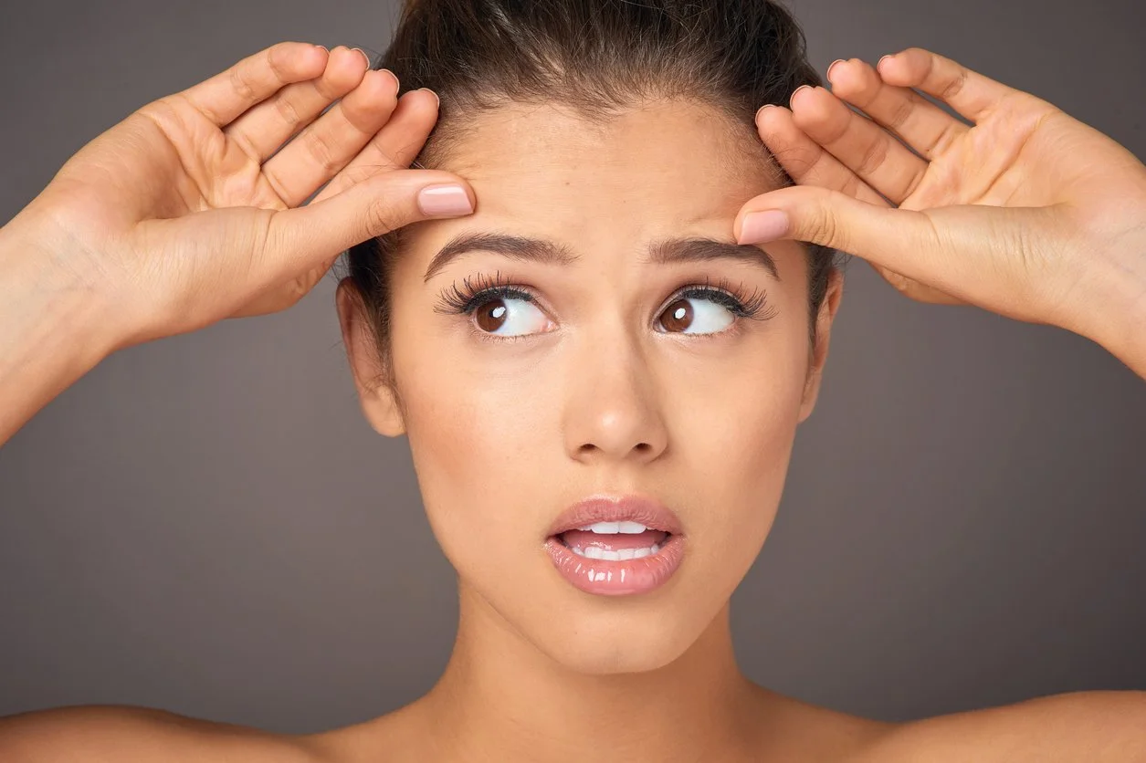 Surrey Botox Patient - Brow lift