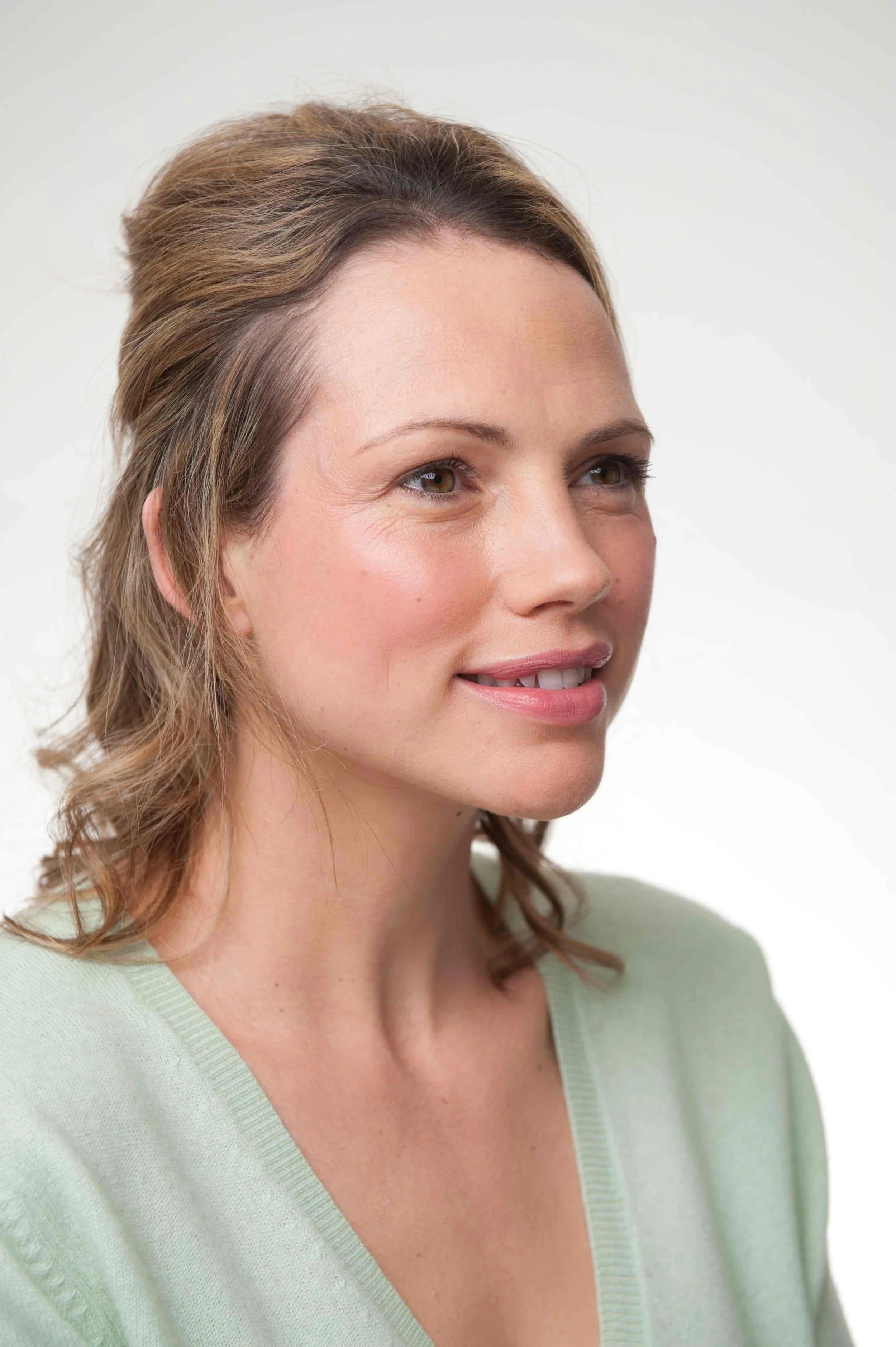 Sculptra v. Dermal Filler
