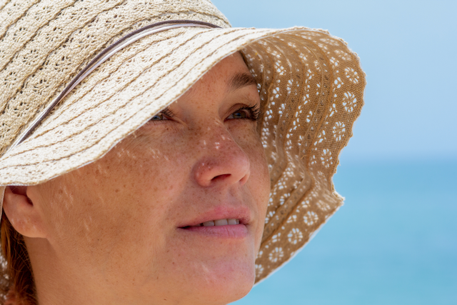 Sun-Damage-corrrection-Cosmetic Doctors Company