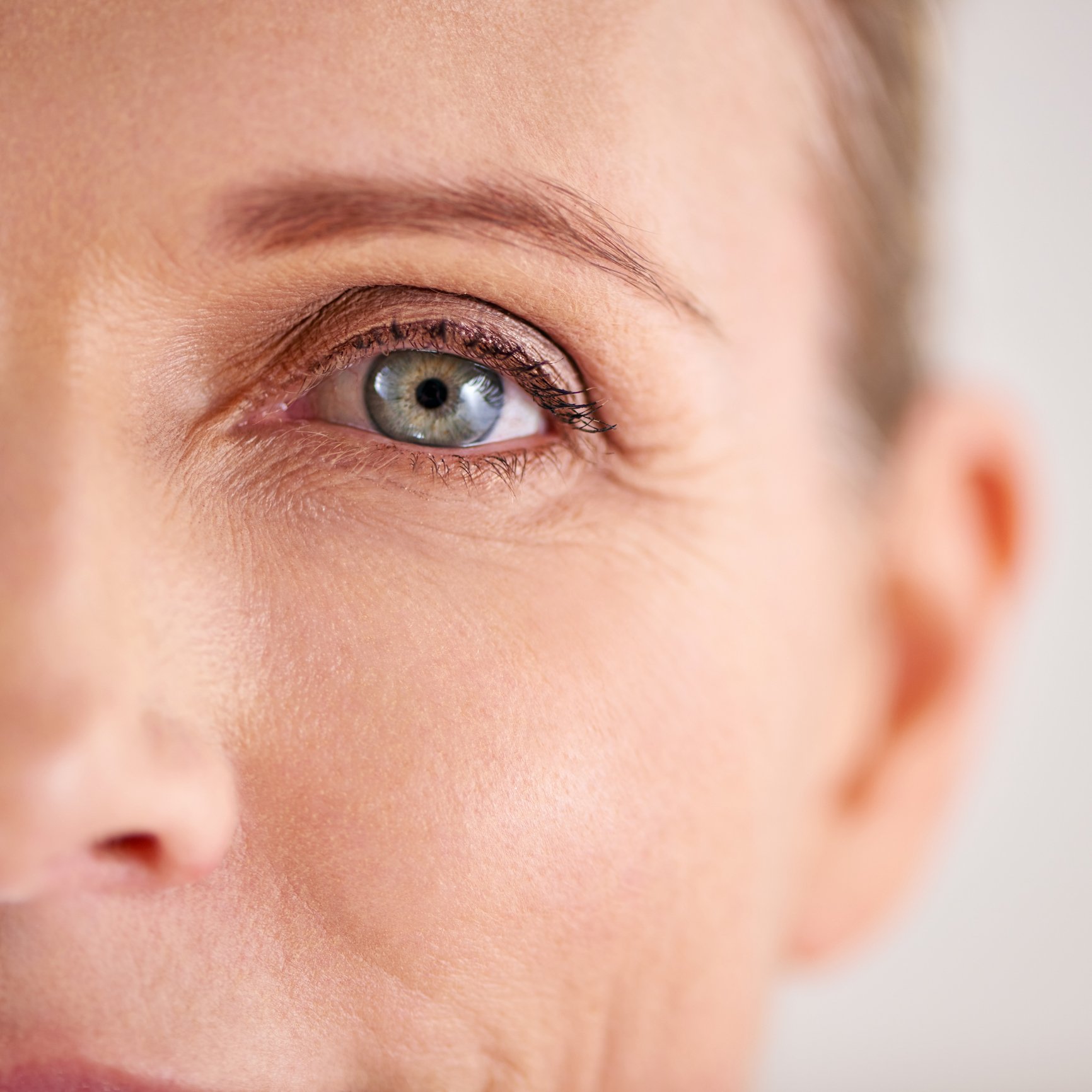 Surrey | anti-wrinkle | crows feet