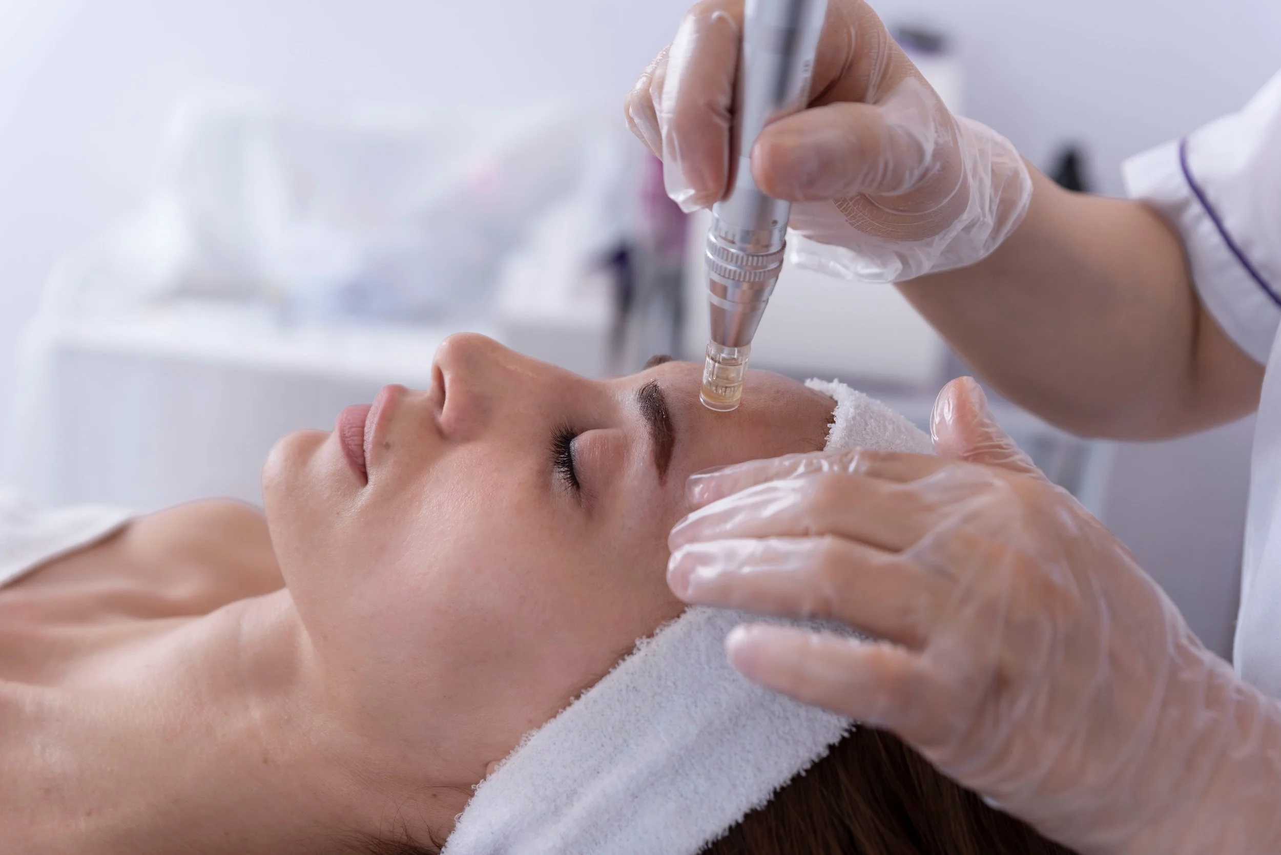 Beautician applying facial dermapen treatment on face of young woman customer in a medspa