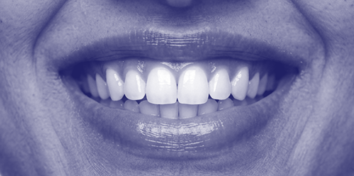 Close-up of a person's smile showing their upper and lower teeth.