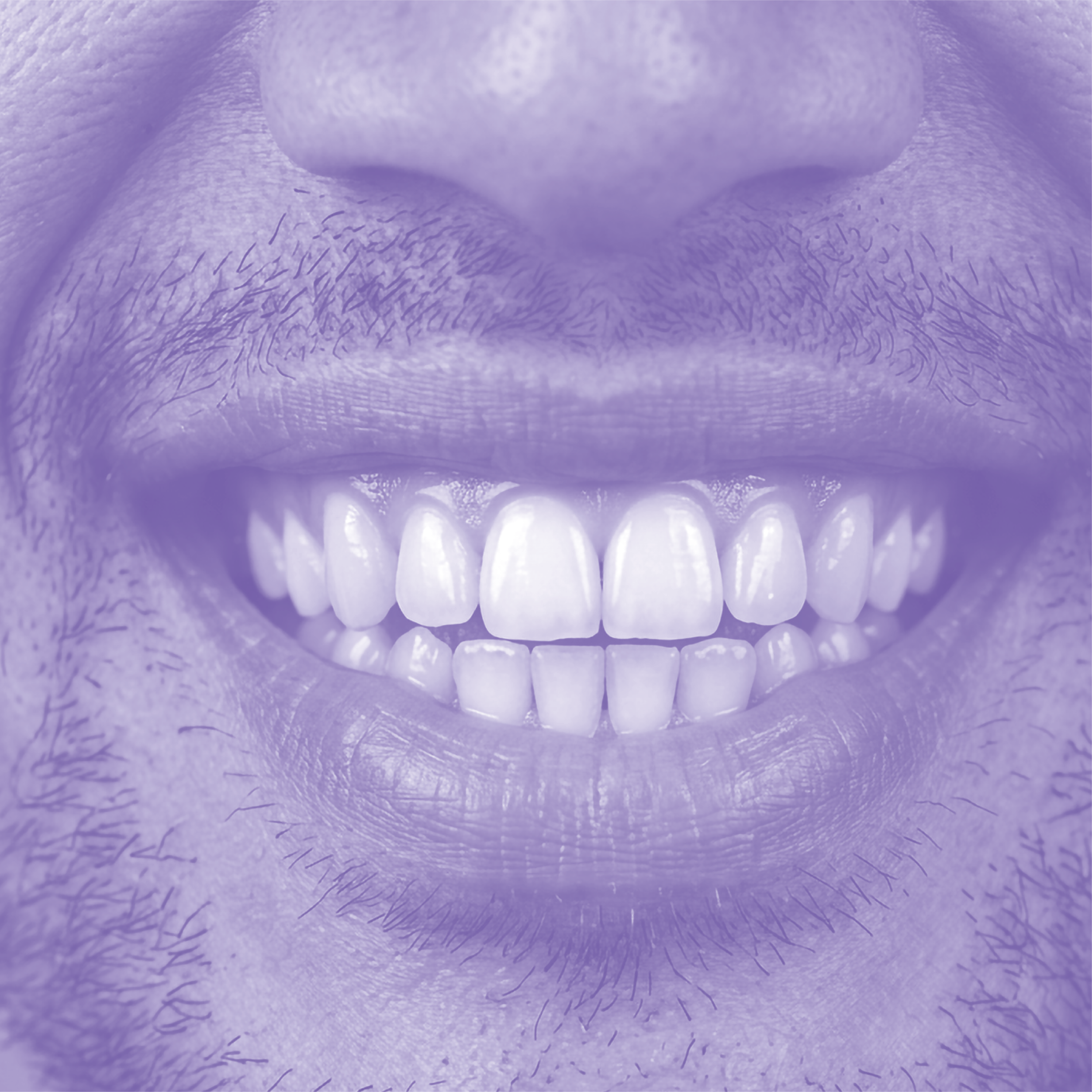 Close-up of a smiling person's mouth showing their teeth and part of their nose and chin, with a purple tint.