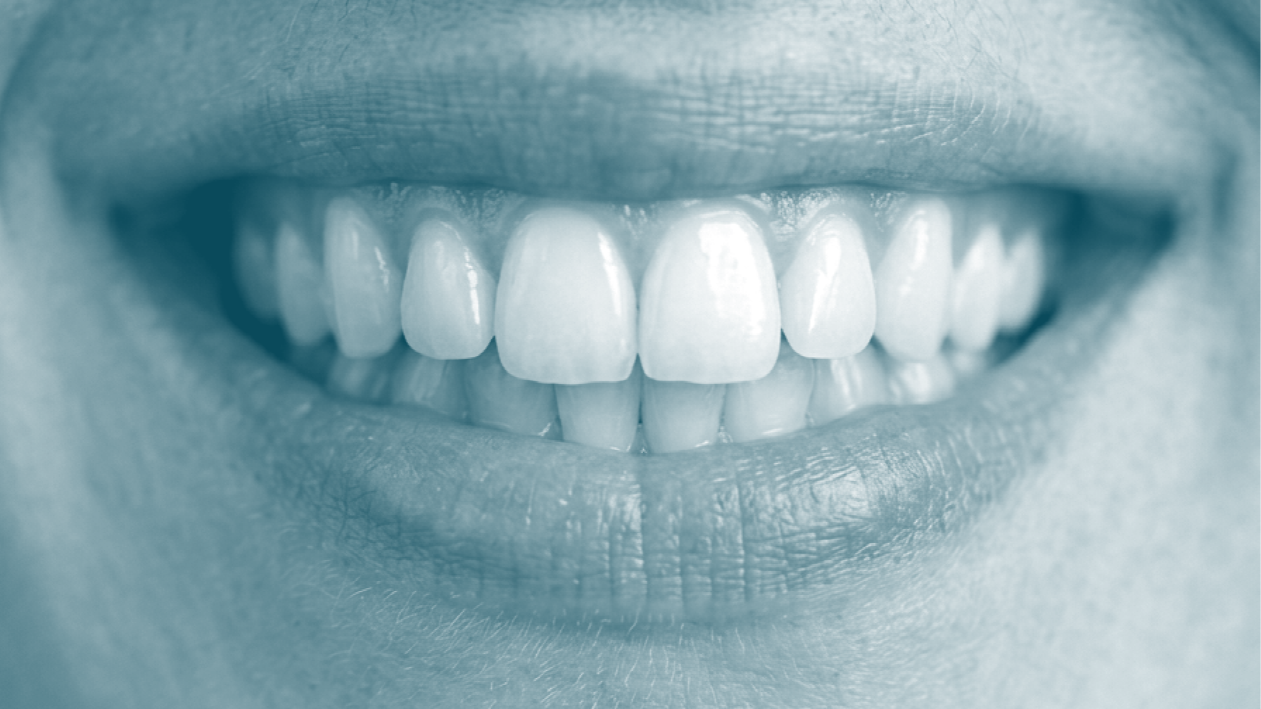 Close-up of a person's mouth showing their upper and lower teeth as they smile.