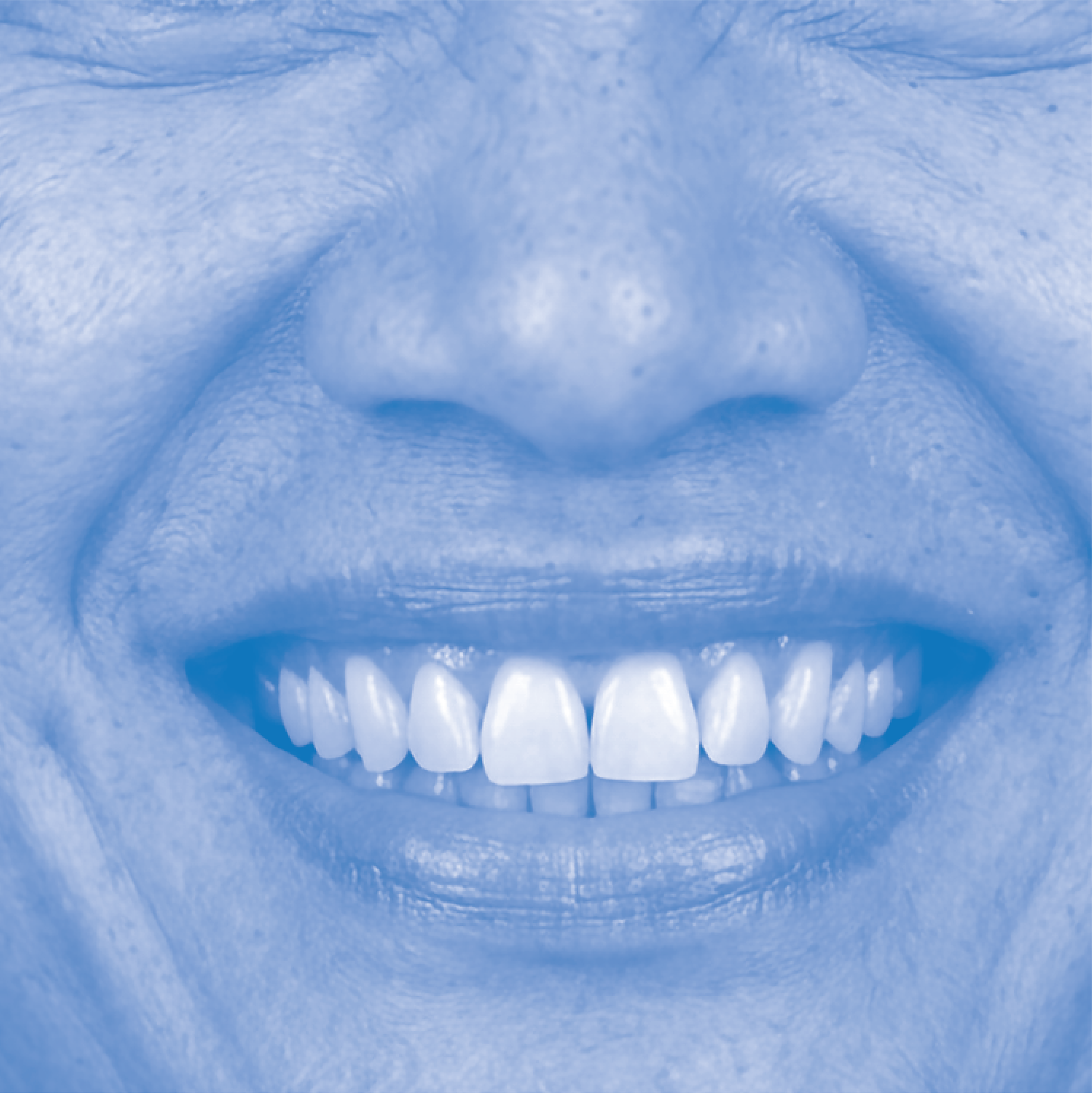 Close-up of a set of human teeth with the upper and lower teeth visible, showing healthy, white teeth and gums.