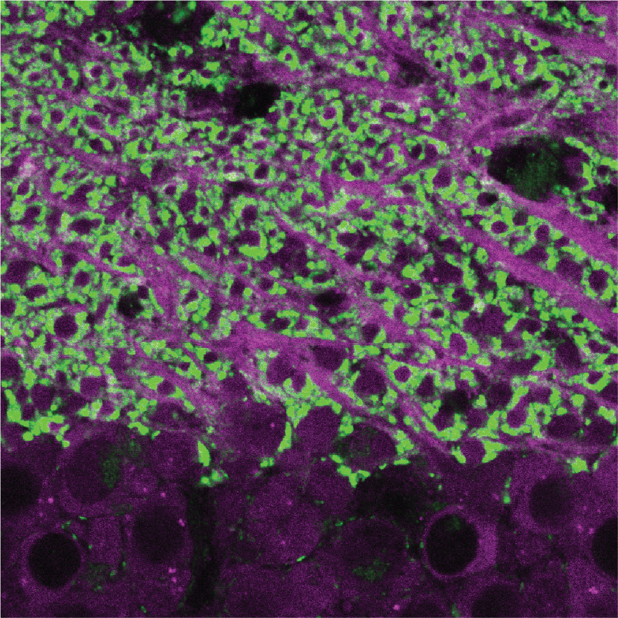 Microscopic image showing cells with green and purple fluorescent staining.