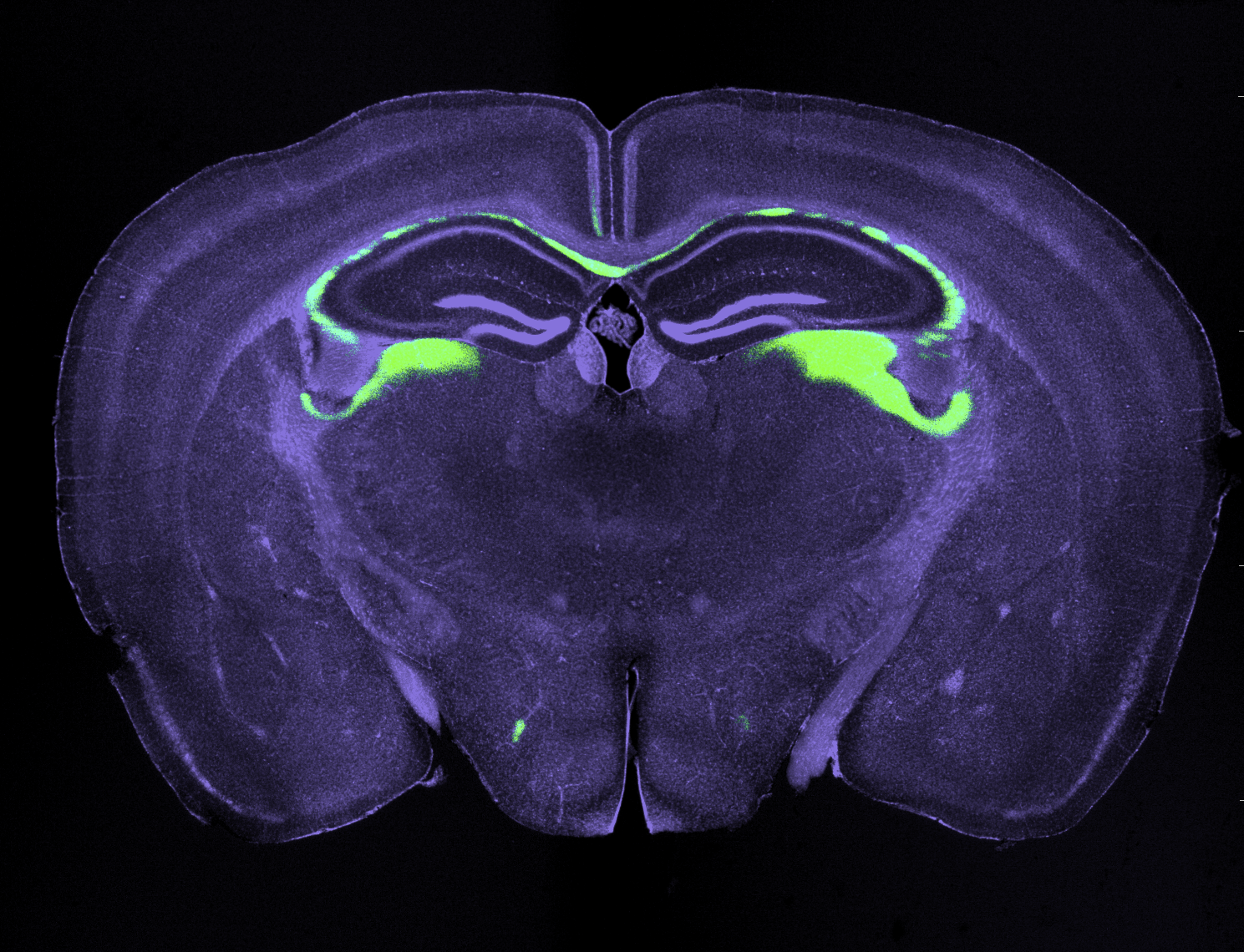 A fluorescently stained cross-section of a brain showing various regions highlighted in green and purple.