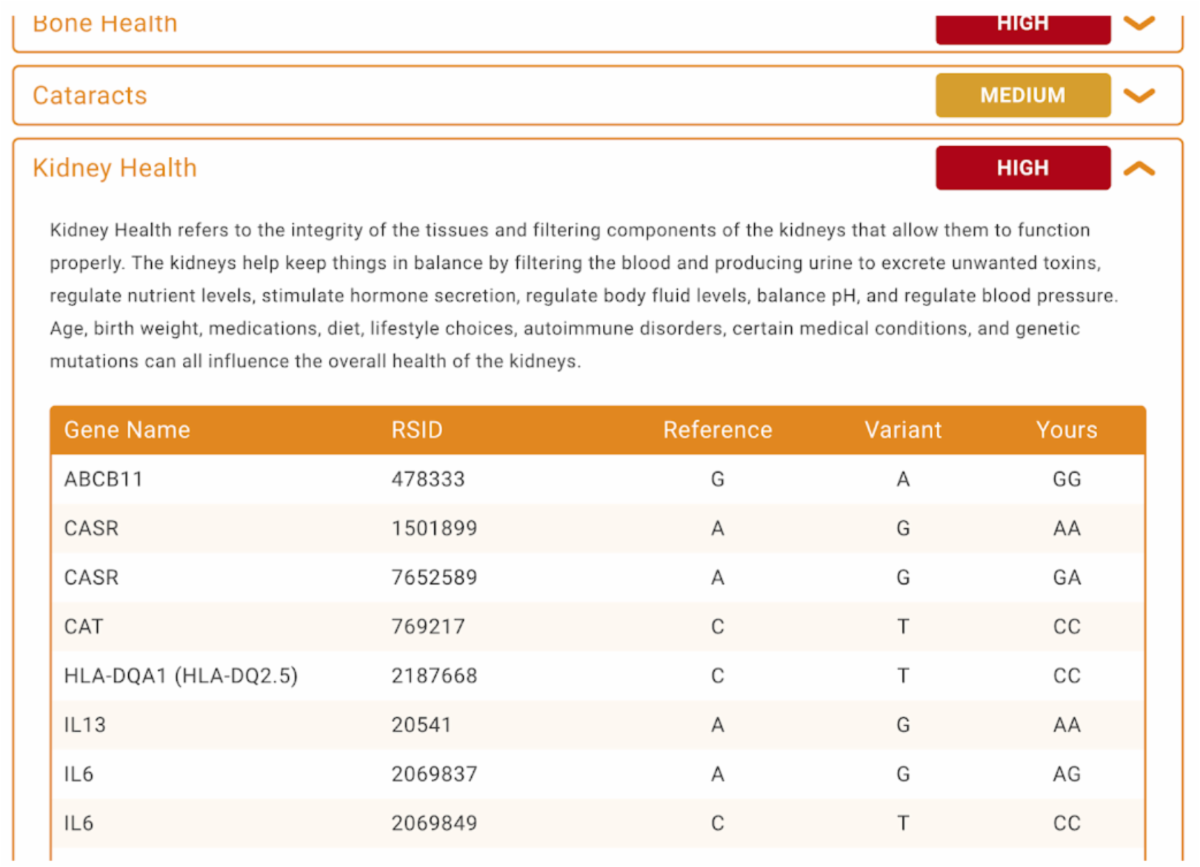 Screenshot of a health report page with sections titled 'Bone Health', 'Cataracts', and 'Kidney Health'. The 'Kidney Health' section indicates a high level of concern. The page contains a table listing genes related to kidney health, including gene names, RSID numbers, references, variants, and personal results.