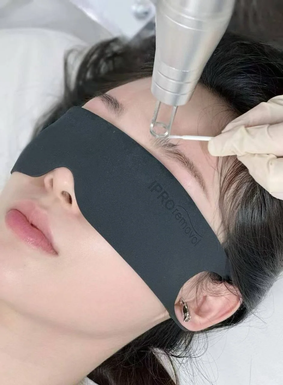 iPRO Precision Removal Technology