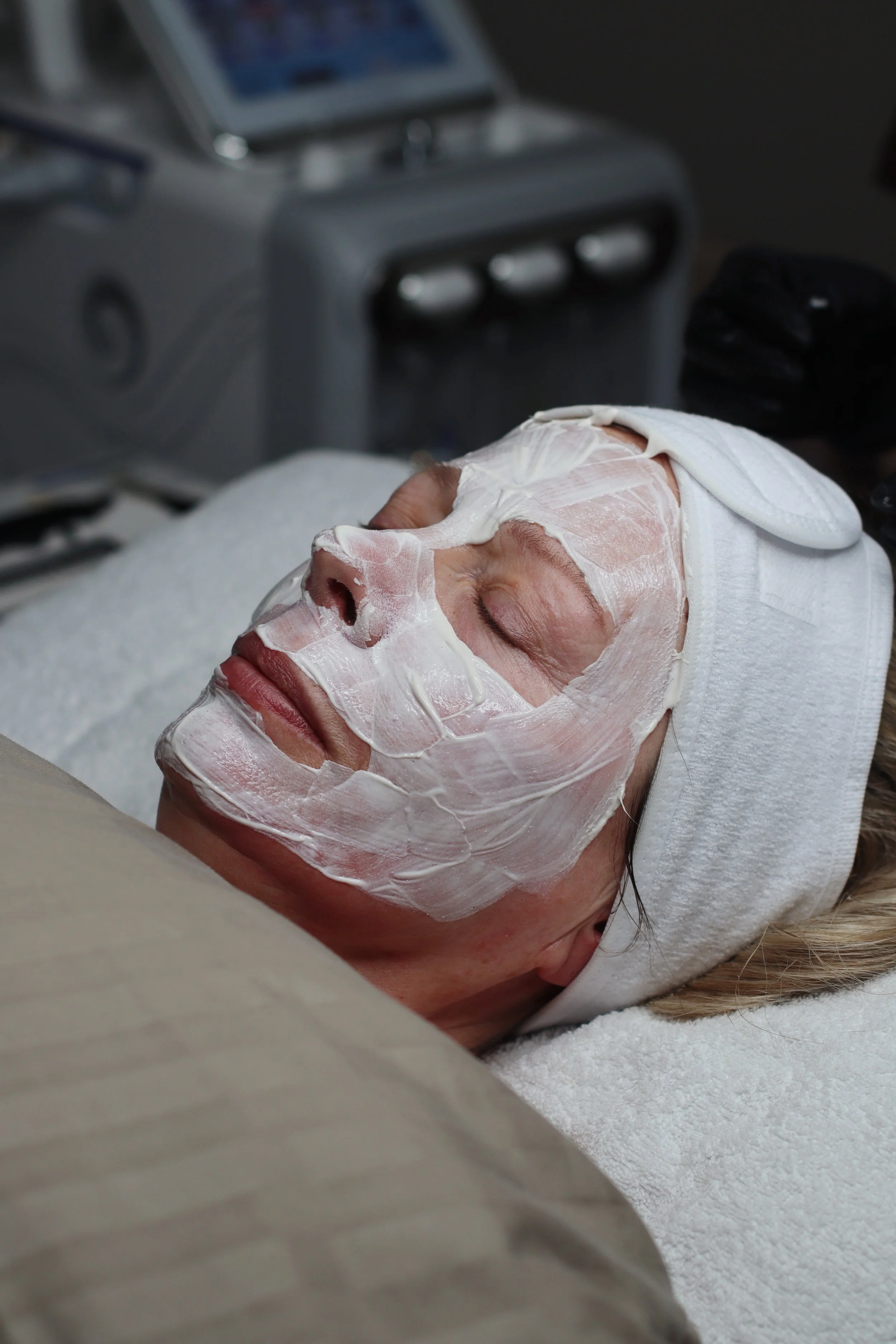 skin peel mask for acne. anti aging facial west malling.JPG