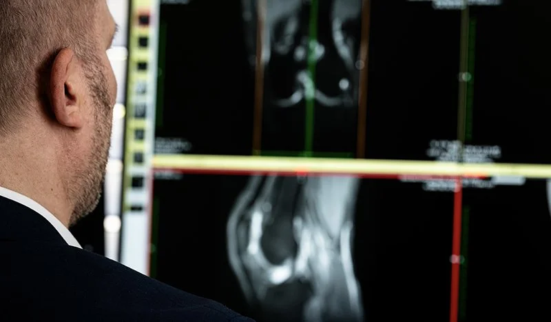 Dr. med. Sebastian Kramer betrachtet ein MRI-Bild eines Knies und erstellt eine radiologische Zweitmeinung.
